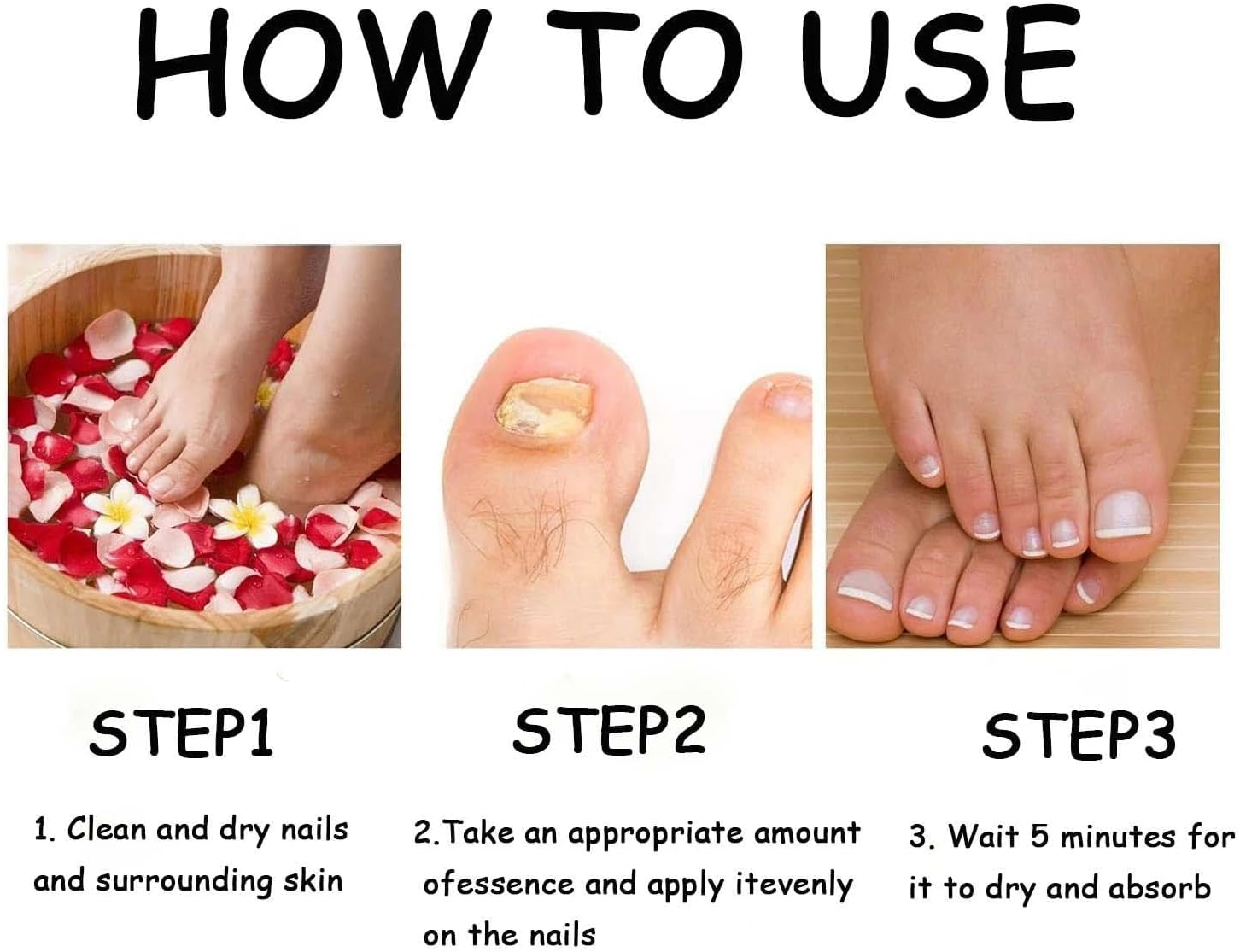 Fungal Nail Treatment - Fast-Acting Solution for Thick, Discolored Toenails &ndash; Revitalize Yellow & Brown Nails with Our Powerful Formula &ndash; Quick, Effective Relief for Beautiful Nails