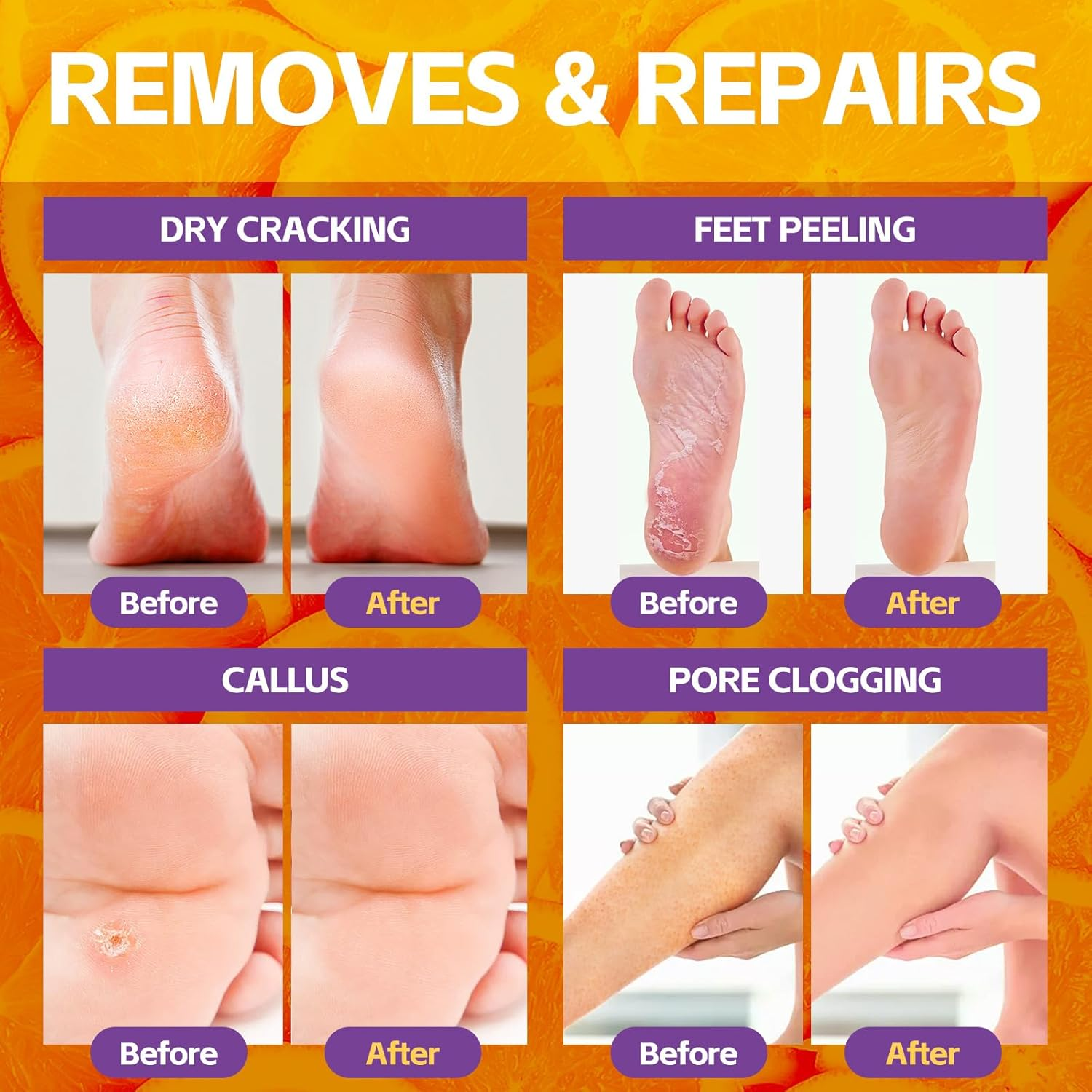 Nbc Beautilab Pedicure Foot Soak, Foot Spa Soak, Pedicure Kit, Bubble Foot Bath for Tired & Dry Cracked Feet, Athletes Feet, Odor Foot and Softens Calluses, Foot Soak 16 Packs a Box, Orange image number 4