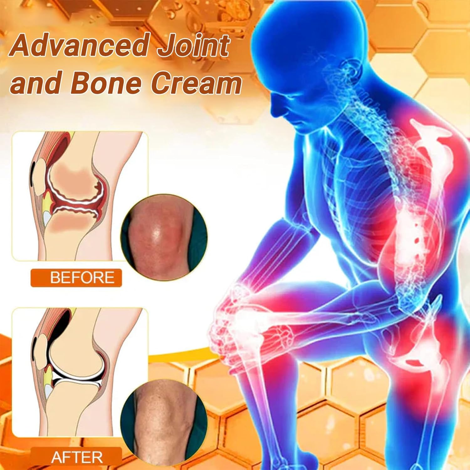 XRLXRL Bee Venom Joint and Bone Cream,Xrlxrl Bee Venom Cream,Improve Joint Mobility, Fast-Acting (4) image number 3