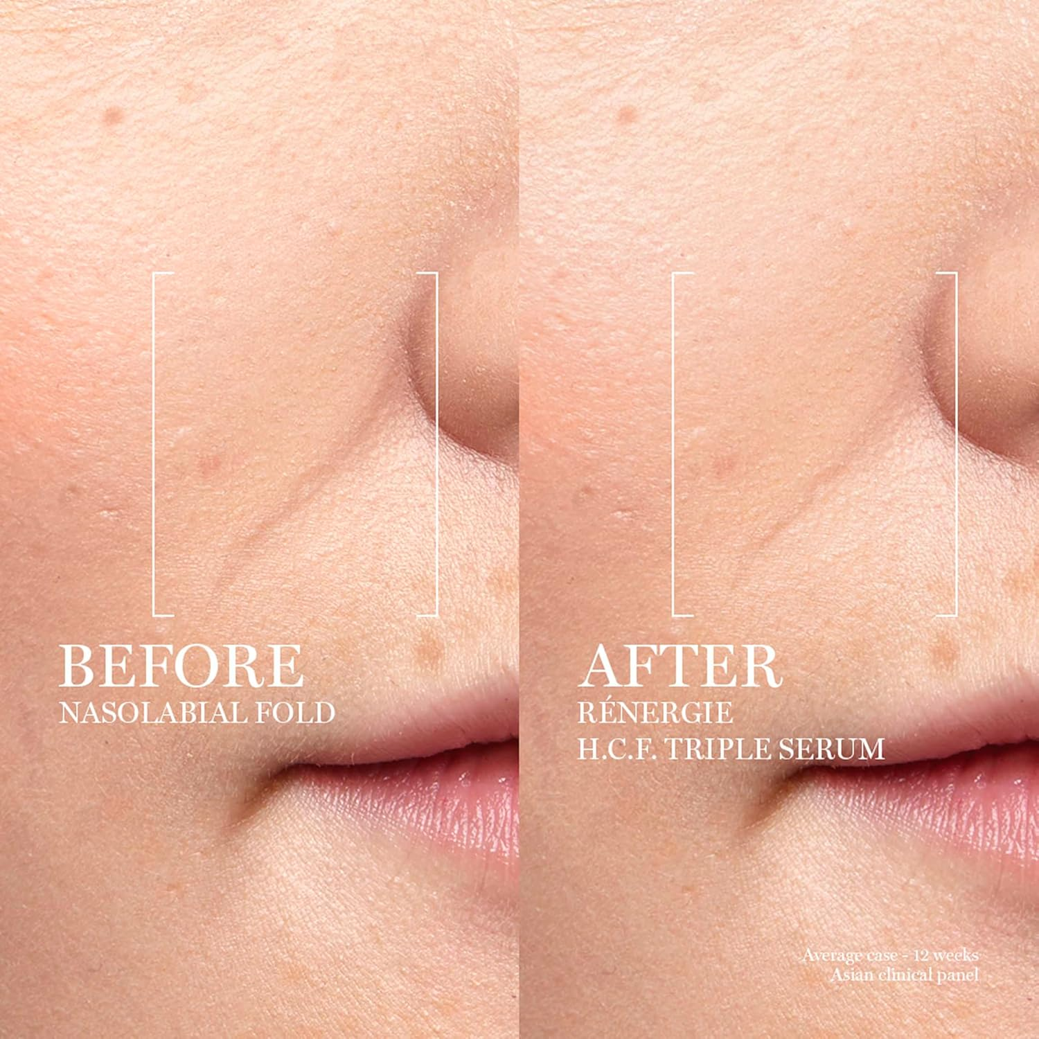 Lanc&ocirc;me R&Eacute;NERGIE H.C.F. TRIPLE SERUM - 50 Ml image number 4