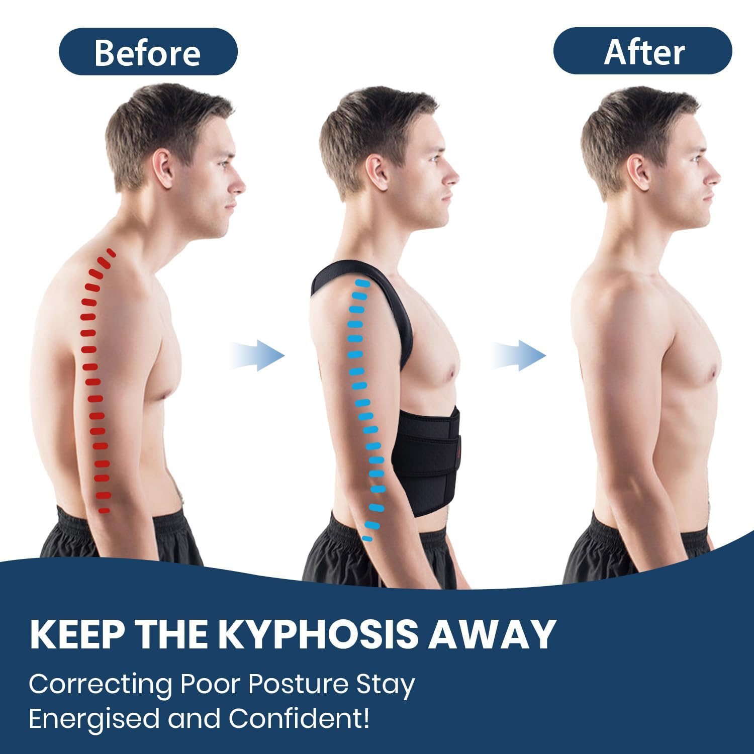 Back Support Posture Corrector for Women Men, Shoulder Supports & Immobilizers Scoliosis and Hunchback Adjustable Belt Back Brace for Lower Back Pain Posture Trainer - Black (S) image number 3