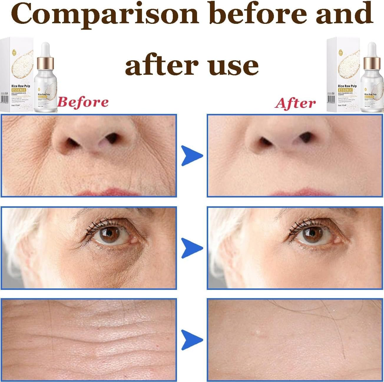 White Rice Anti-Wrinkle Essence,Facial Serum Massage for Woman,Collagen Anti-Wrinkle White Rice Facial Essence,Reduce Fine and Lines Face Serum image number 5