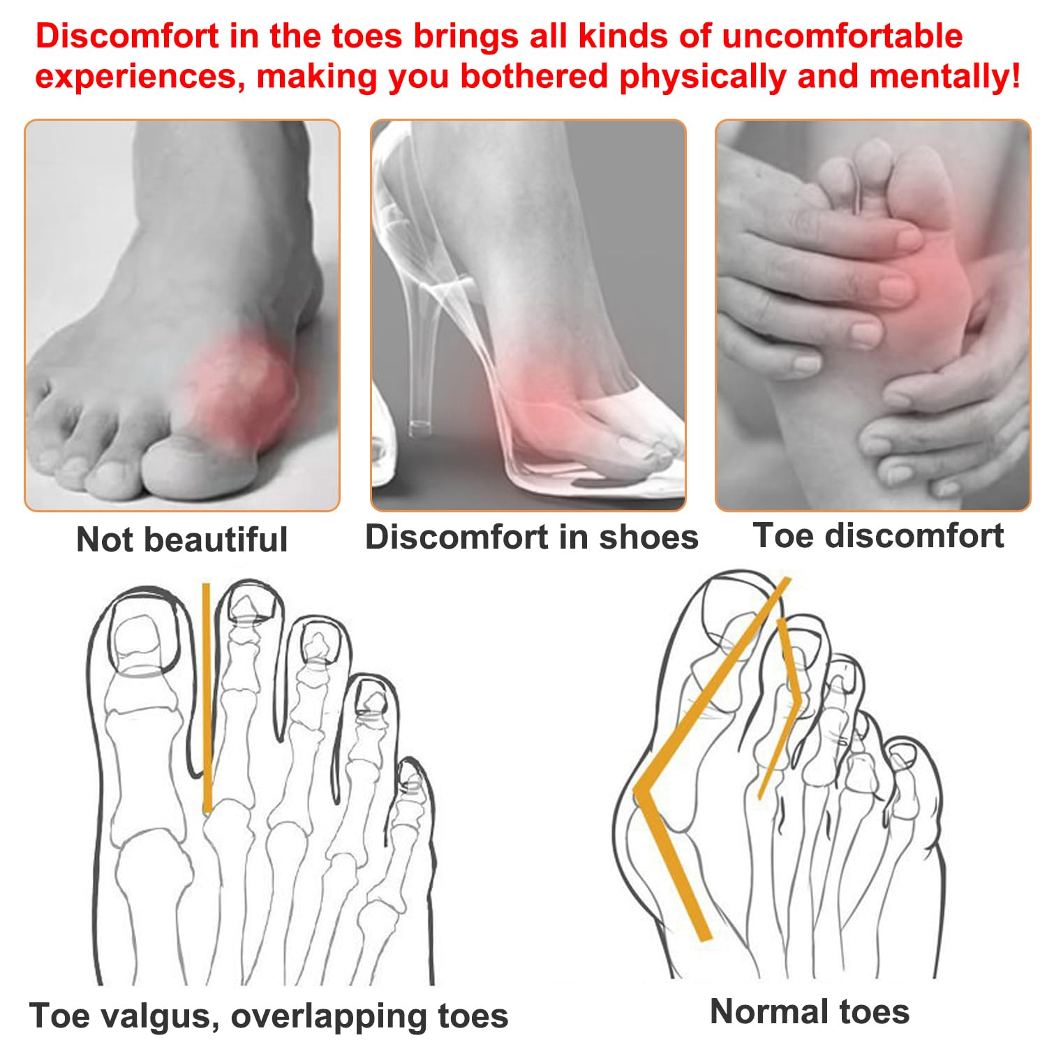 Bunion Correctors Toe Straightener, 10 Pcs Gel Bunion Guard Bunion Protector, Bunion Pads, Bunion Relief with Gel Shield, Toe Spacers Gel Toe Separators Big Toe for Hallux Valgus Relieve (Transparent) - Transparent image number 2