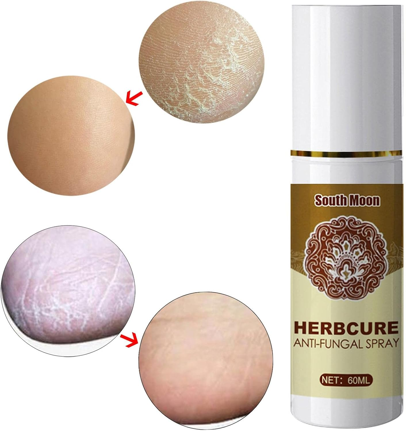 Foot Spray Anti-Fungal Infection Beriberi Spray Damaged Skin Moisturizer image number 4