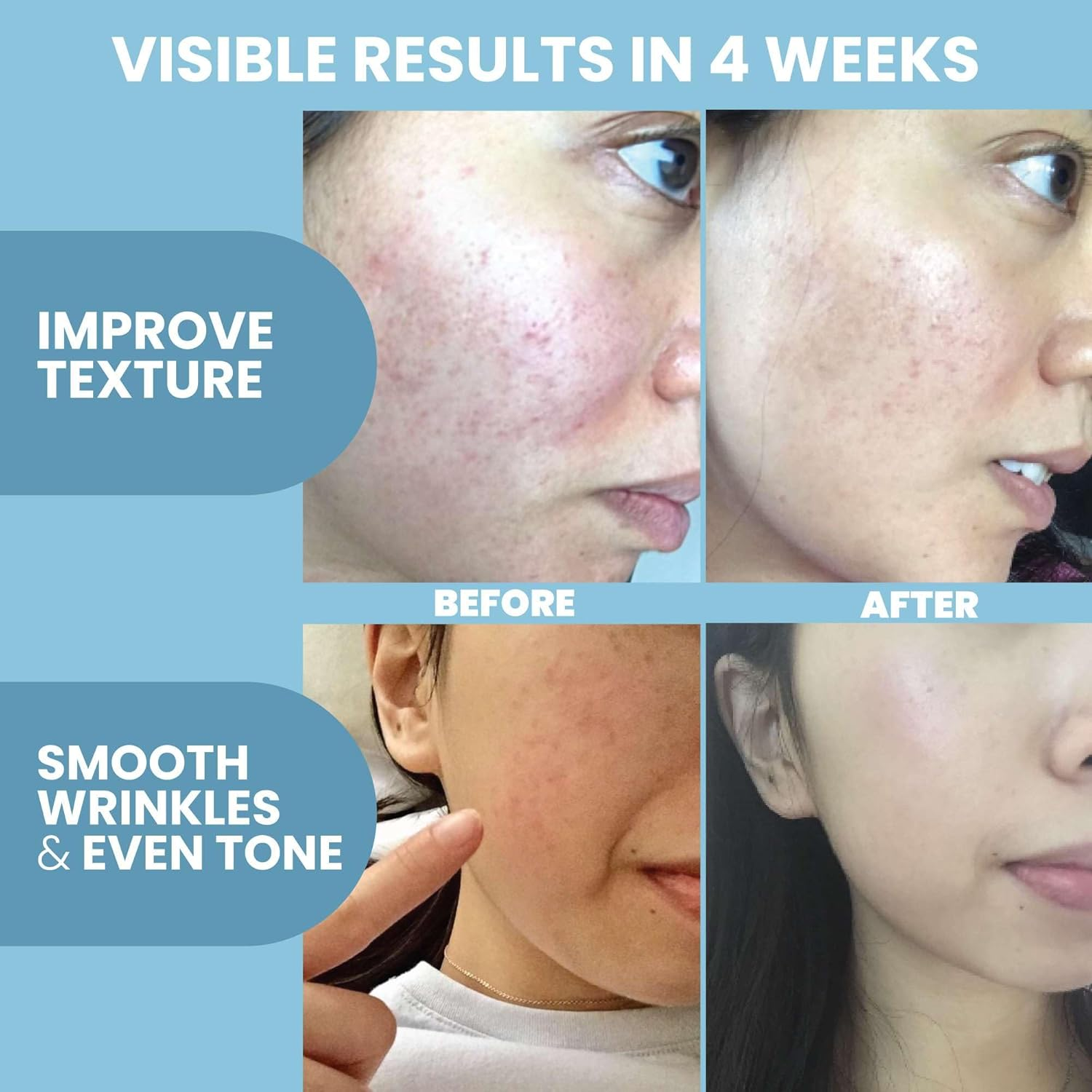 Peptide Complex Serum by Eva Naturals (2 Oz) - Best Anti-Aging Face Serum Reduces Wrinkles and Boosts Collagen - Heals and Repairs Skin While Improving Tone and Texture - Hyaluronic Acid & Vitamin E image number 1