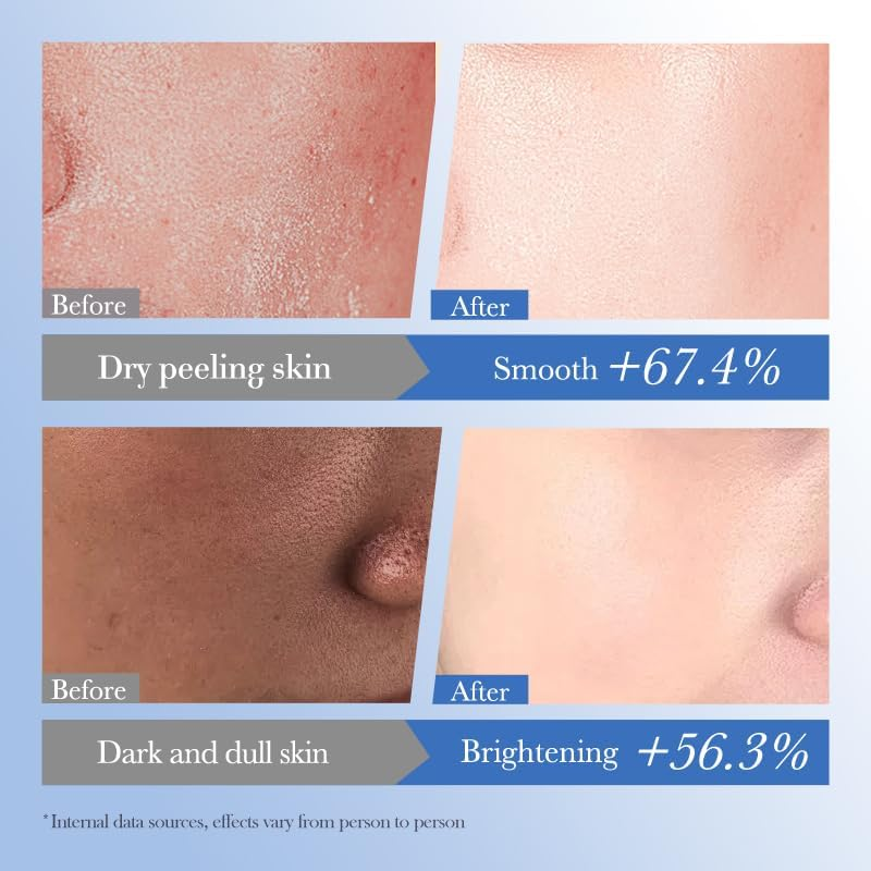 Ceramide Hyaluronic Acid Moisturizer Reducing Dryness Prevent Dry Smooth Skin Improves Skin Elasticity image number 3