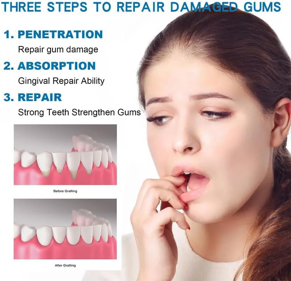 5Pcs Gum Restore Drop for Adults - Gum Repair Regrowth for Receding Gums Treatment & Stain Removal Natural, Bad Breath Treatment & Fresh Breath & 30Ml Portable Oral Care Solution image number 3