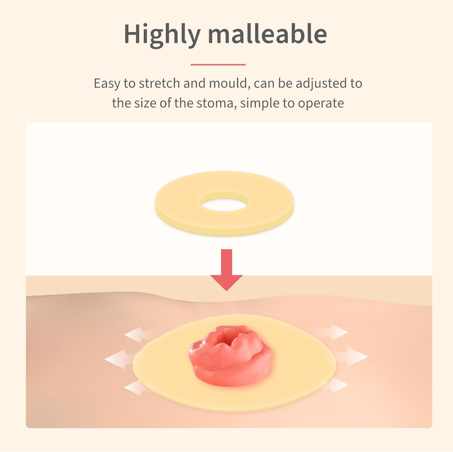 DERAYMI 10 Pack Moldable Ostomy Barrier Rings, 2Mm Thickness Sting-Free Elastic Ostomy Rings Hydrocolloid Ileostomy Barrier Rings Secure Seal for Colostomy Bags image number 4