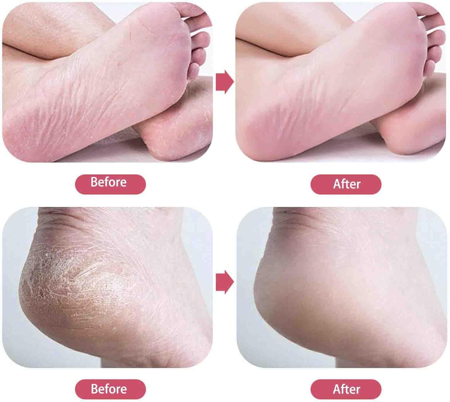 Malora Glass Foot,Malora Glass Foot Filermalora Foot Scrubber,Malora Foot Filerglass Foot Files for Feetglass Foot File Callus Removerfoot Care Pedicure Tool for Dry Feet Care (G) - C image number 5