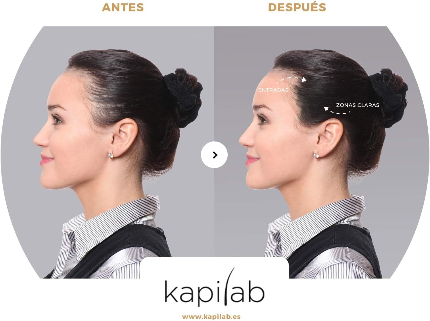 Kapilab Scalp Mask - 4G - Medium Brown image number 2