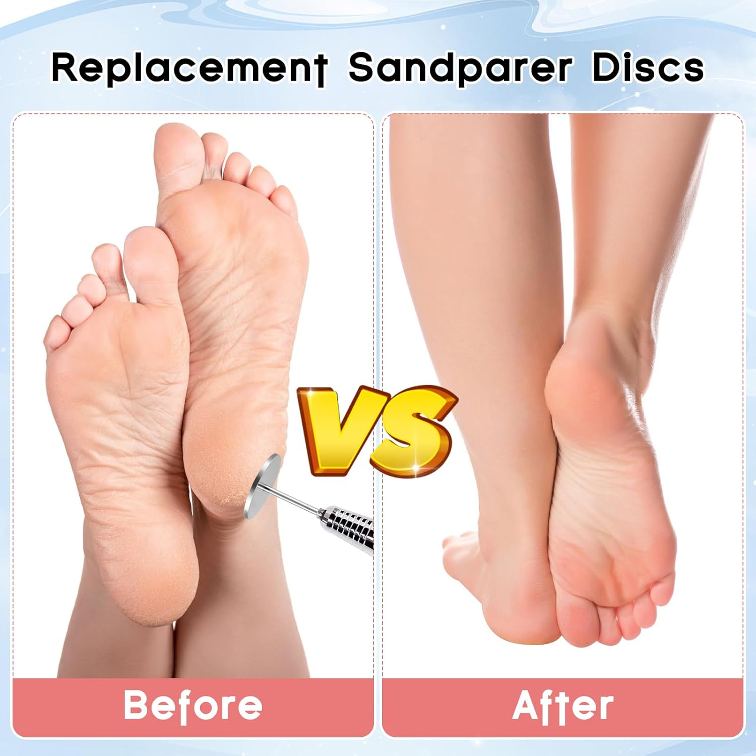 Zhufubao Pack of 80 Sanding Discs Pedicure 25 Mm Pedicure Sandpaper Discs (Grit 80 150 180 240), 1 Level Axis, Dead Skin Callus Remover for Manicure and Pedicure