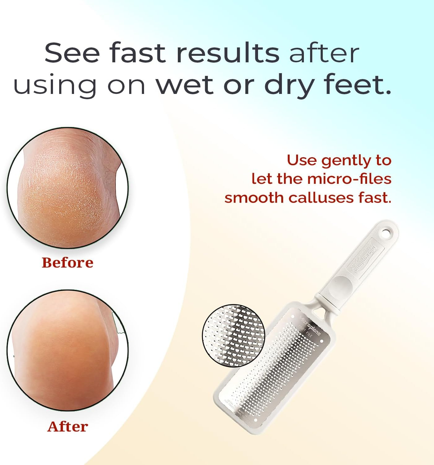 Microplane Colossal Foot File Scraper - the Original Stainless Steel Foot Rasp, Dead Skin/Callus Remover for Feet, Gentle Foot Scrubber, Pedicure Tools for Salon-Quality Foot Care, White image number 3