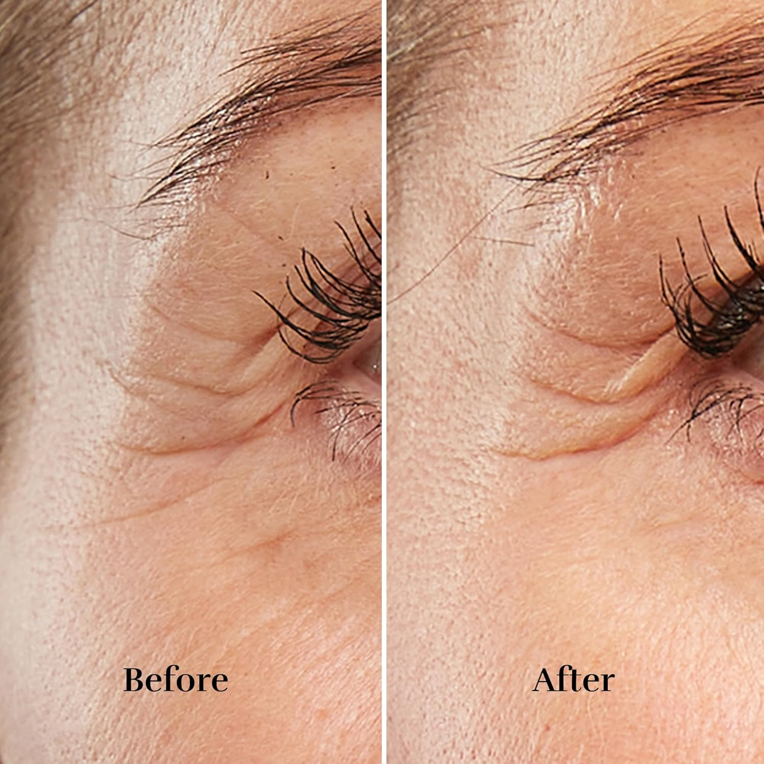 Silk'N Facetite Mini Wrinkle Reduction & Skin Tightening Cordless Beauty Device, Non-Surgical Treatment for Younger Looking Skin image number 3