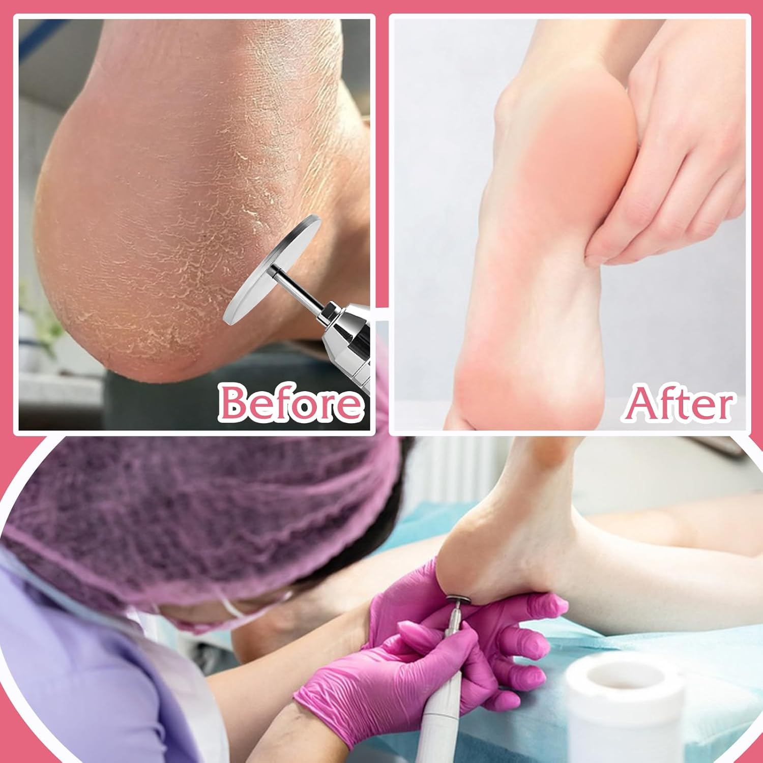 72Pcs Sanding Paper Discs with Metal Nail Drill Bit 25Mm Replacement Sandpaper Disk for Manicure Pedicure Sanding Discs Bits for Electric Callus Foot File Remover Tool (#80#150#240 Grit) image number 5