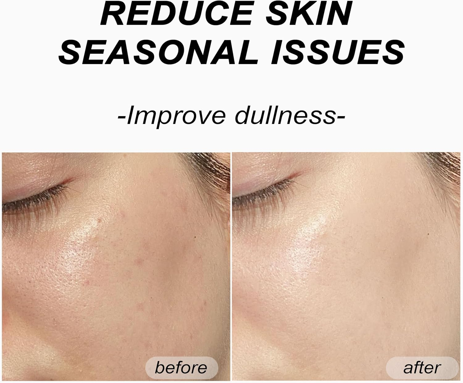 Bukamkom Collagen Face Mask (8 Pcs), Hydrogel Overnight Face Mask for Hydration & Soothing, Hydrogel Collagen Facial Mask, Facial Masks Skincare image number 6