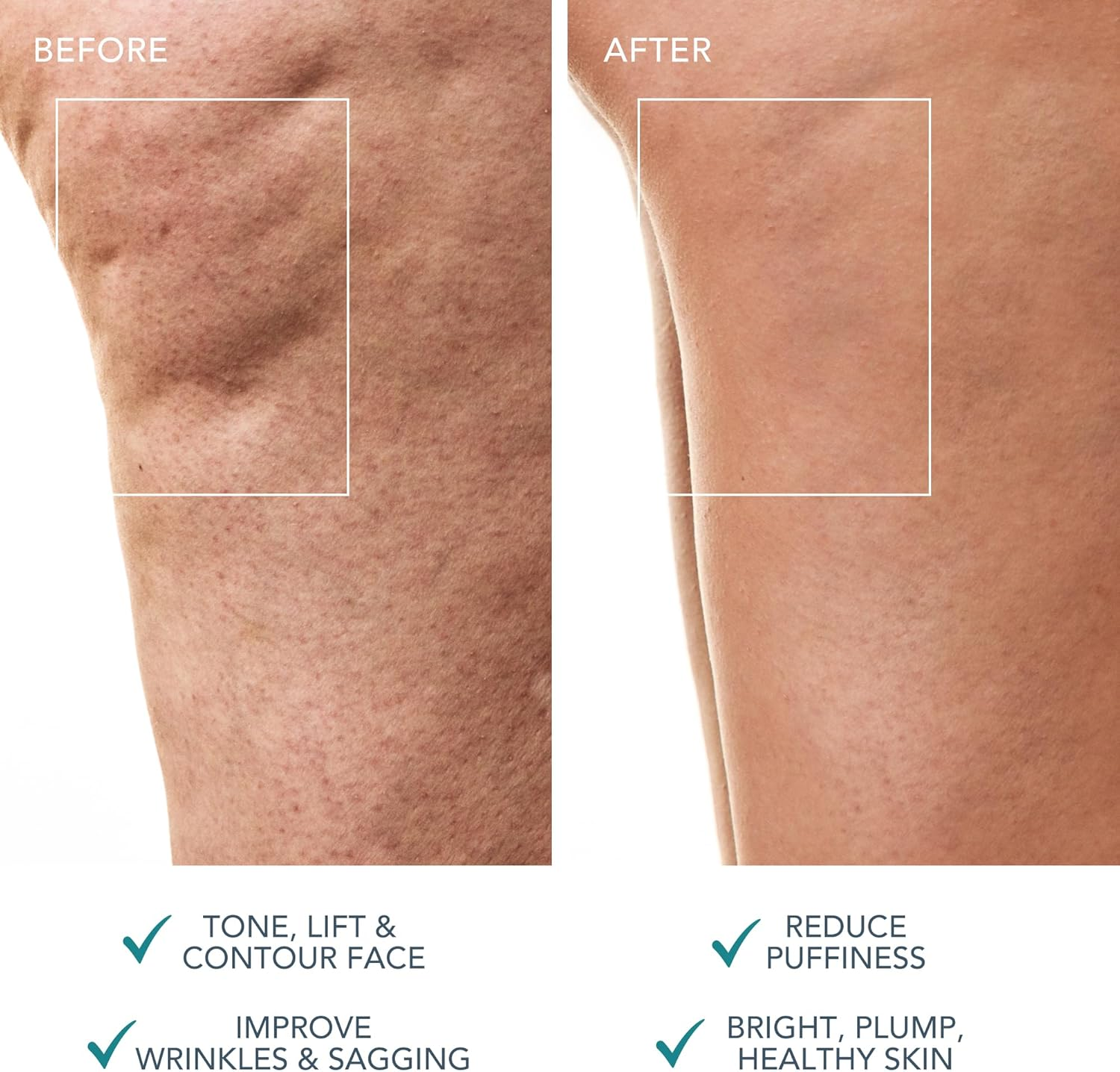 FOREO Bear 2 Body - Evergreen image number 6