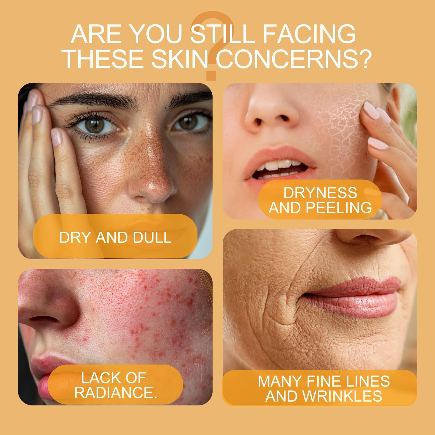 Bee Venom Cream &ndash; Anti-Aging Face Moisturizer for Wrinkle Removal, Firming & Lifting &ndash; Deep Hydration & Skin Recovery &ndash; Suitable for All Skin Types (20G/ 1 Pack)