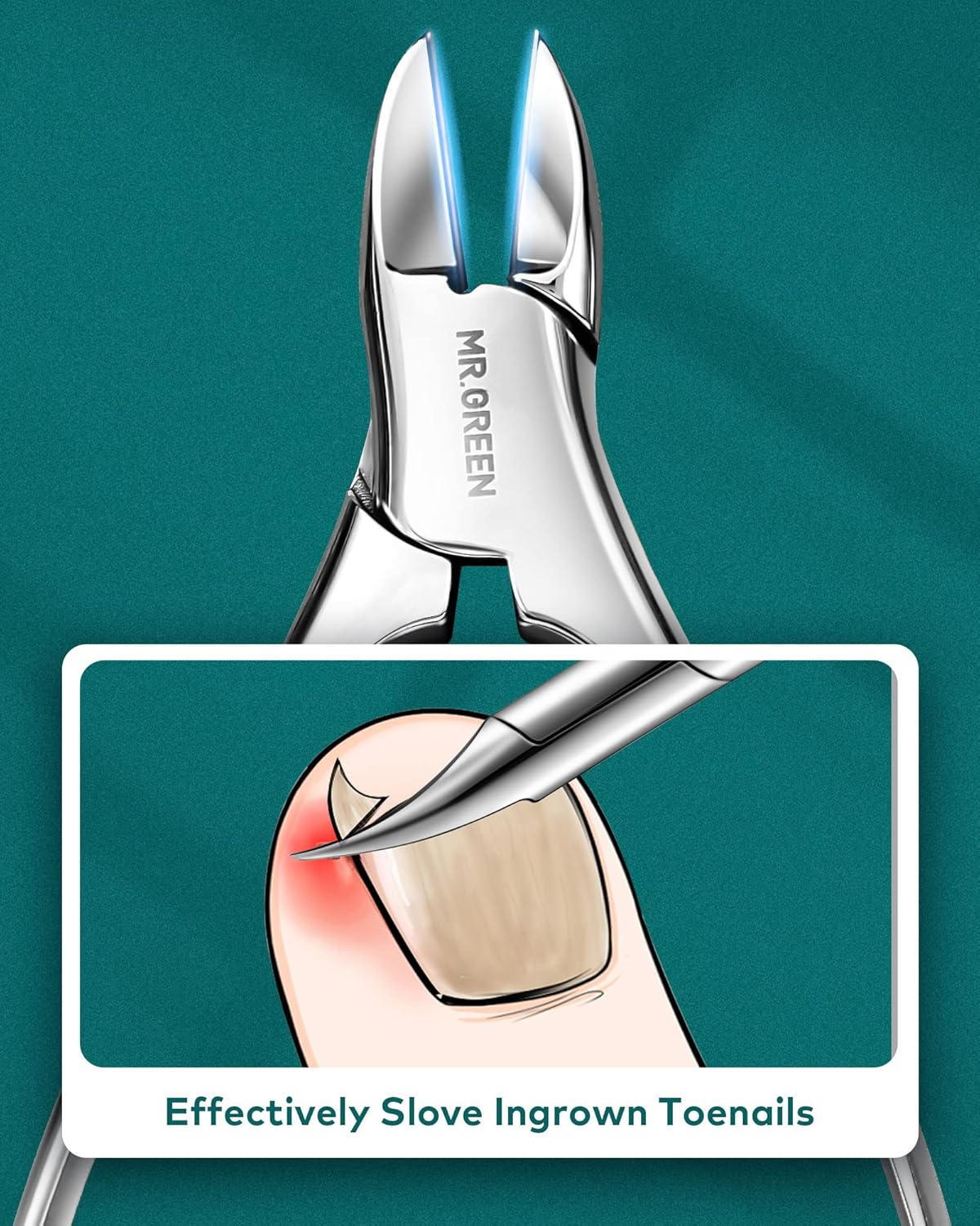 MR.GREEN 8 Pcs Manicure Set Pedicure Kit, German Stainless Steel Nail Clippers Set Heavy Duty Kit, Professional Personal Nail Care Tools with Exquisite Leather Case for Men and Women