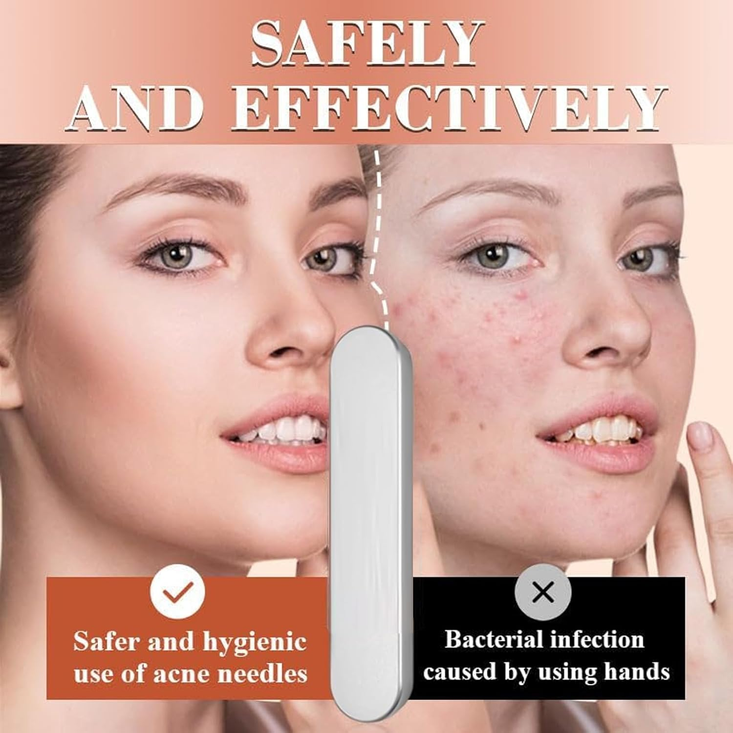 Comedone Extractor Tool: 7-Piece Stainless Steel Kit for Blackhead/Whitehead Removal. This Pimple Popper Tool Kit Works on Nose, Face&mdash;Safe, Durable, Ideal for Blemish Care. a Practical Set for Daily Skincare. image number 2