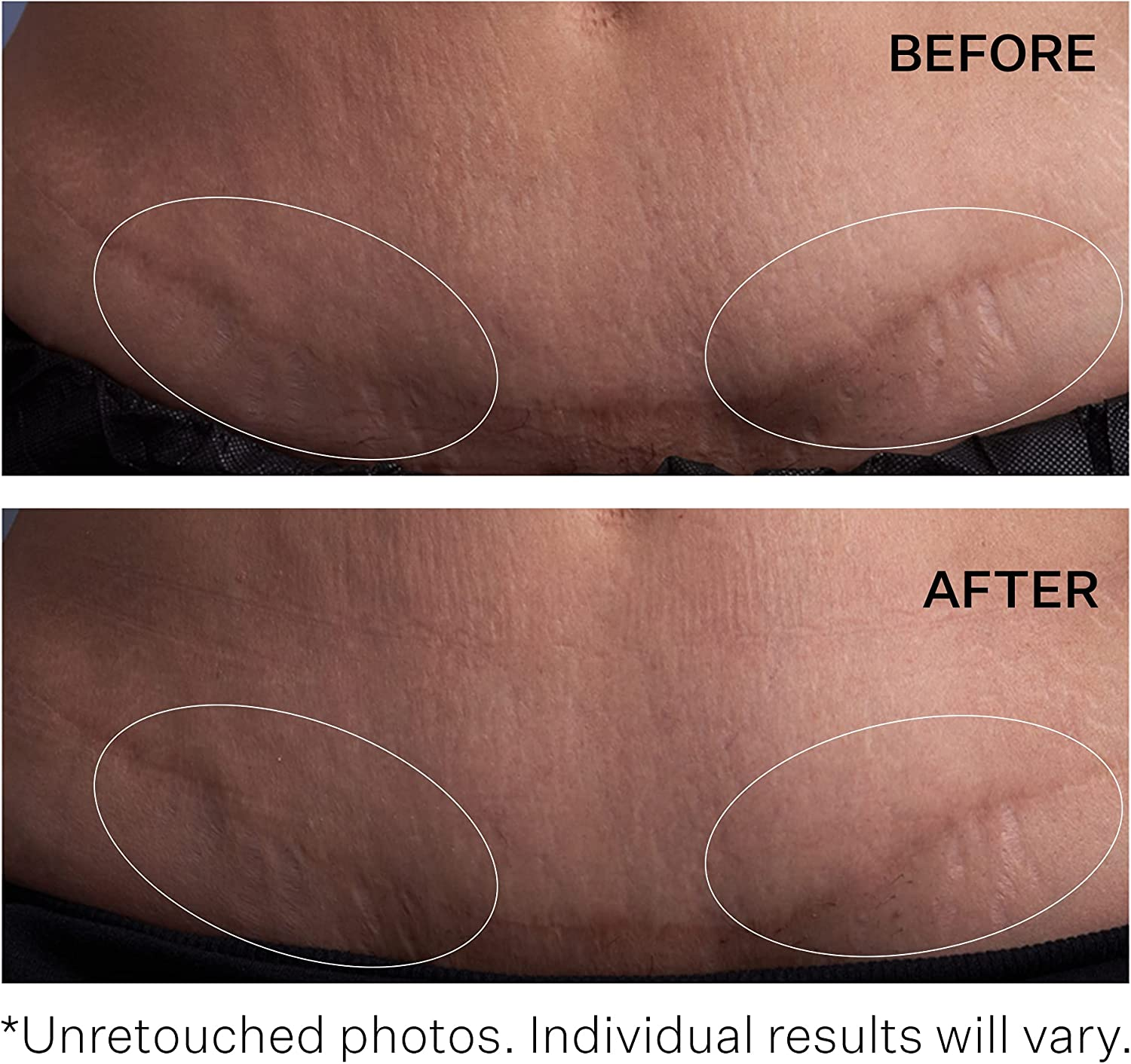 Strivectin Strivectin SD Advanced plus Intensive Moisturizing Concentrate for Unisex 4 Oz Moisturizer, 118 Ml image number 3