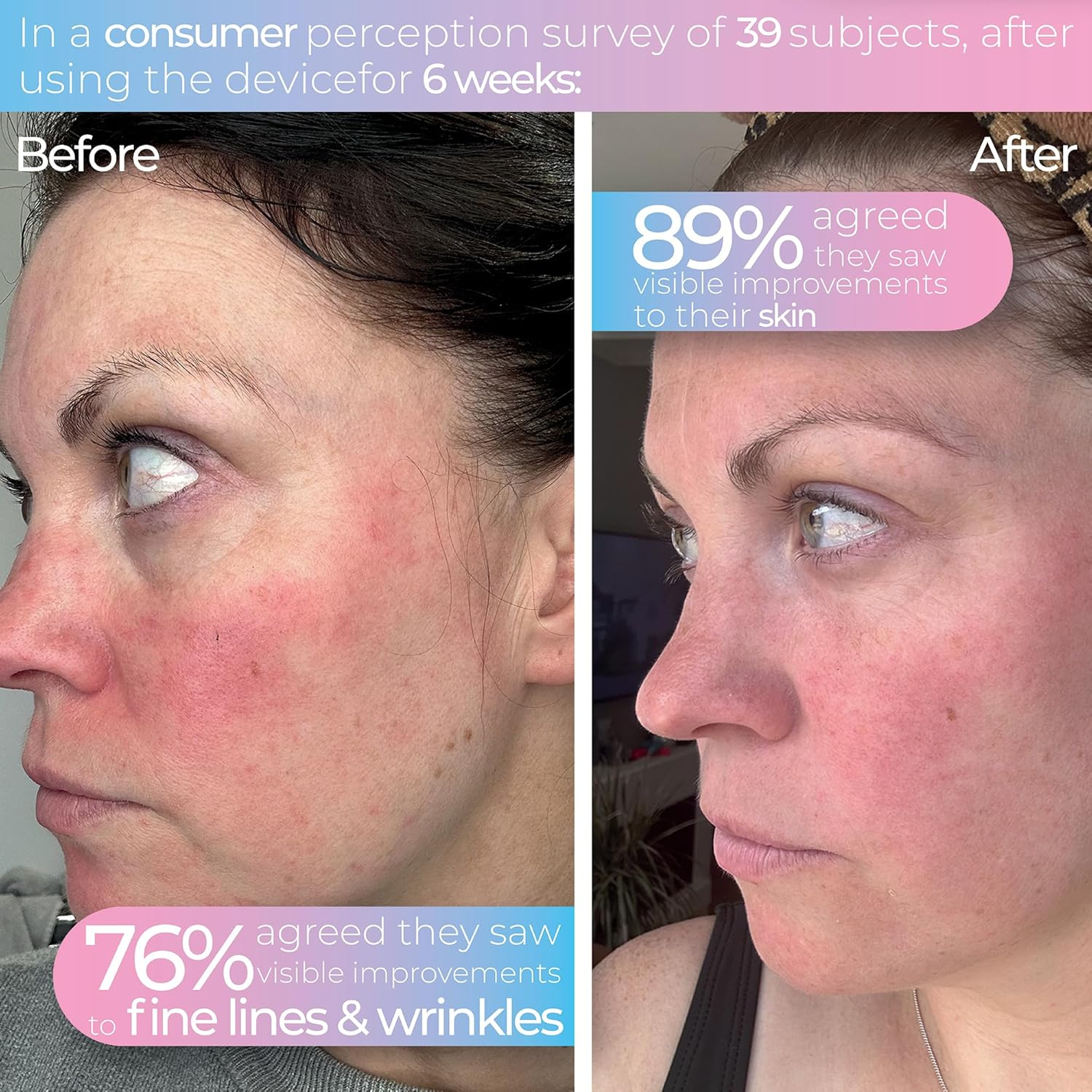 STYLPRO Wavelength LED Face Mask - Multi-Mode Skincare with Red, Blue, Near-Infrared Light for Wrinkles, Blemishes - Flexible, Rechargeable, User-Friendly, Designed in UK, Professional-Grade image number 3