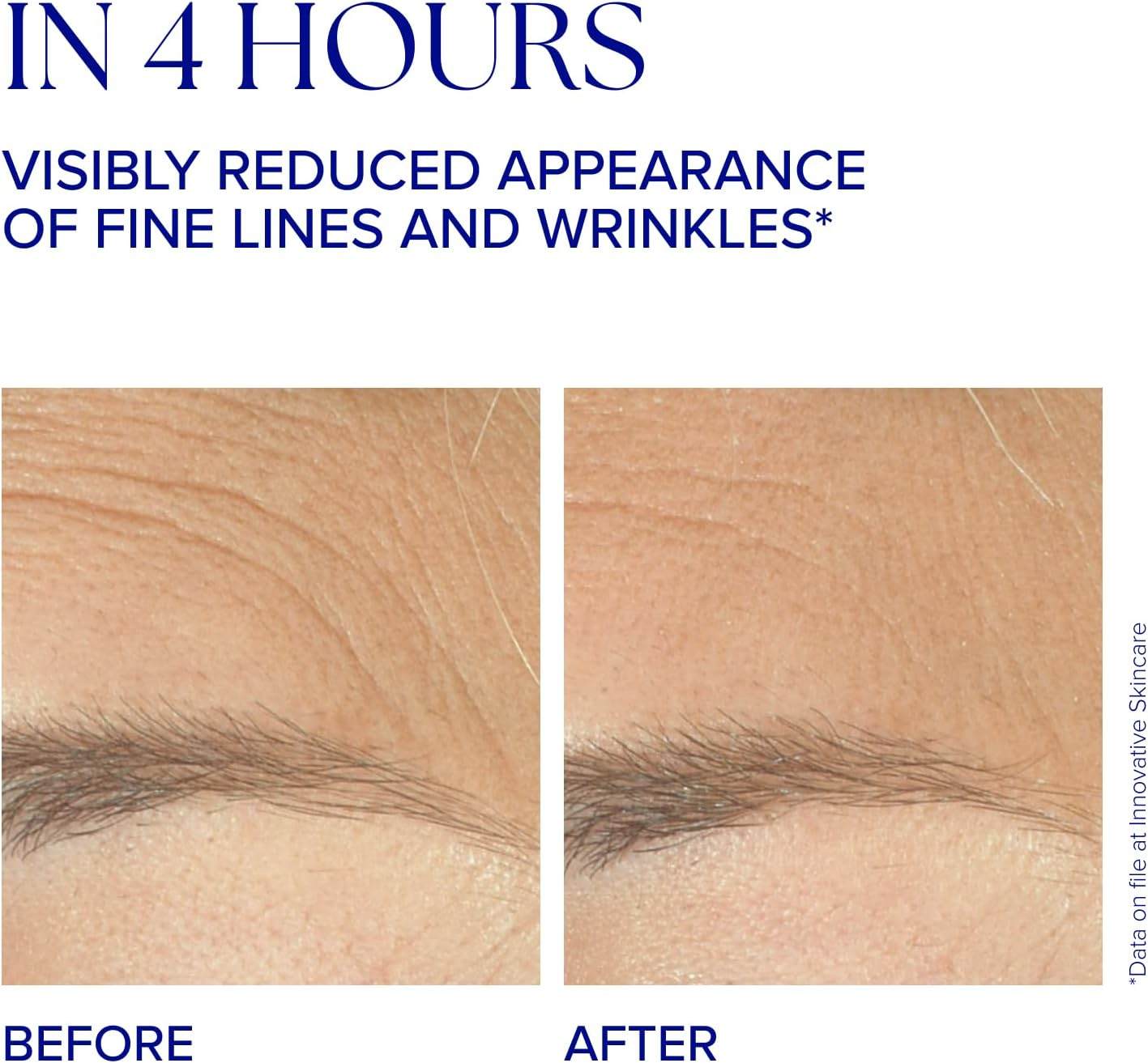 Is Clinical Youth Complex for Unisex 1 Oz Treatment image number 3