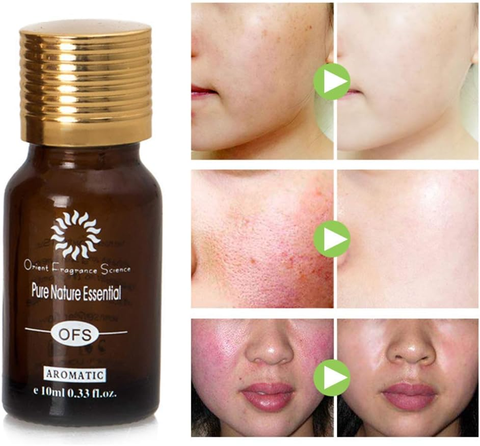 Ultra Brightening Spotless Oil Skin Care, Whitening Whitening, Hydration Helps the Blemishes Scaring Stretch Marks to Fade Skin Sores, Dark Spots Age Spots Hyper Pigmentation image number 5