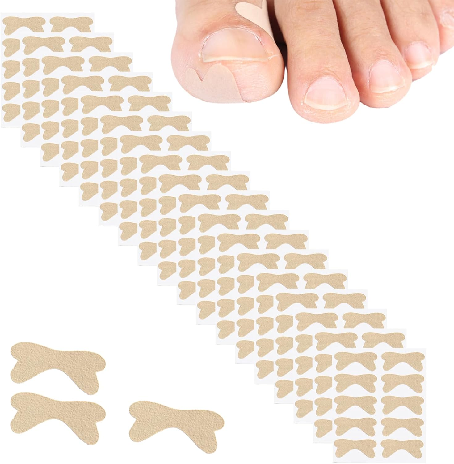 Ingrown Toenail Corrector, 180PCS Breathable Self-Adhesive Ingrown Toenail Patches, Pain Relief Nail Patches