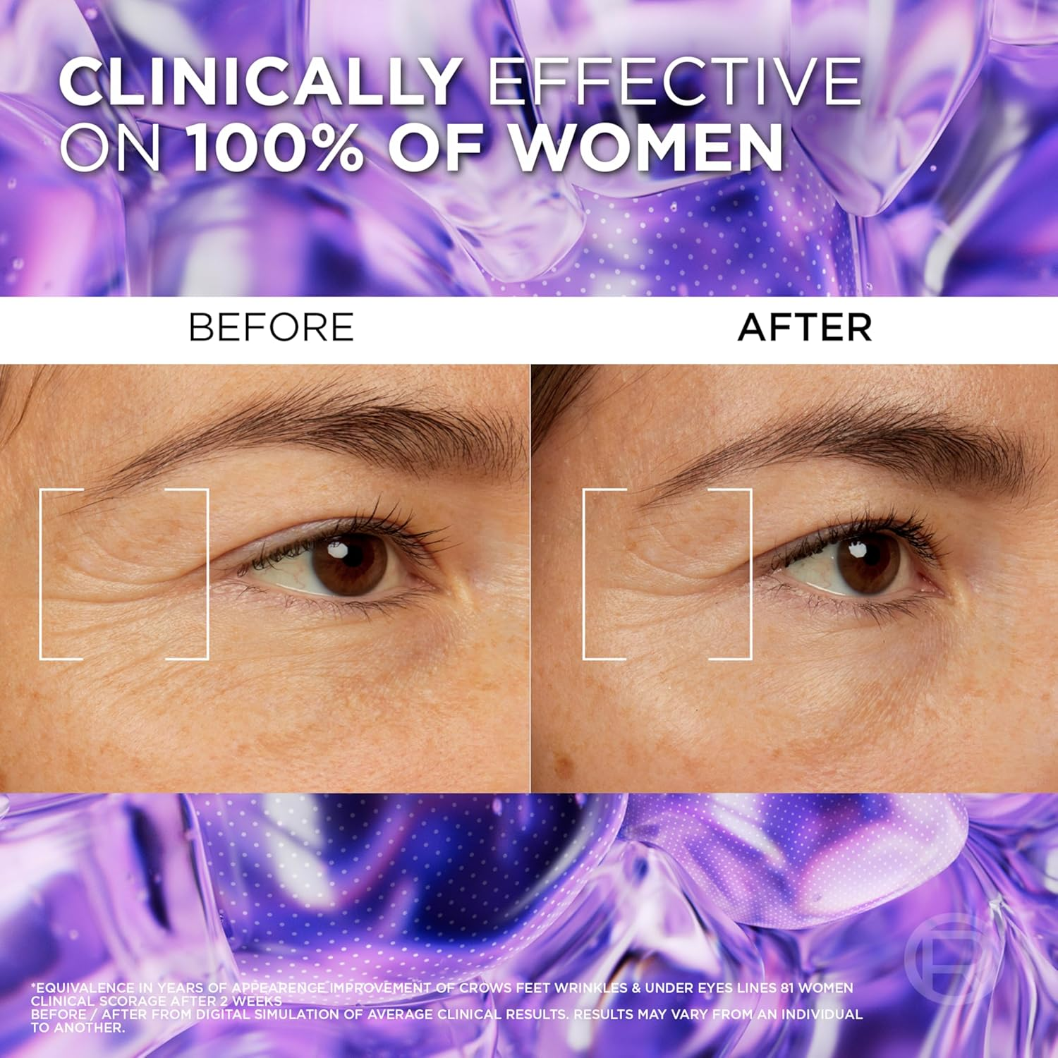 L&rsquo;Or&eacute;al Paris Eye Serum, Energising & Smoothing, Revitalift Filler 2.5% Hyaluronic Acid + Caffeine, 20 Ml