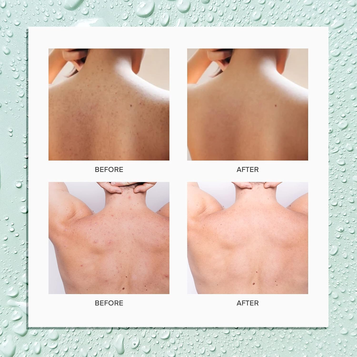 Hypochlorous Acid Spray, Hypochlorous Acid Face and Skin Spray for Clear, Soothe & Moisturize, Safe for Use on Acne Prone Skin, Dry Scalp, Toner, Eye Lash Cleanser-100 ML (2) image number 5