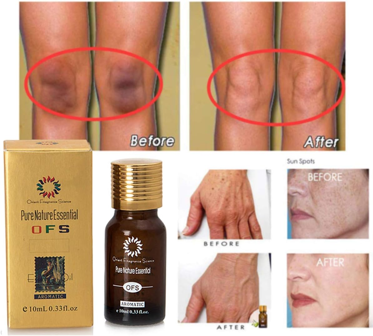 Ultra Brightening Spotless Oil Skin Care, Whitening Whitening, Hydration Helps the Blemishes Scaring Stretch Marks to Fade Skin Sores, Dark Spots Age Spots Hyper Pigmentation image number 1