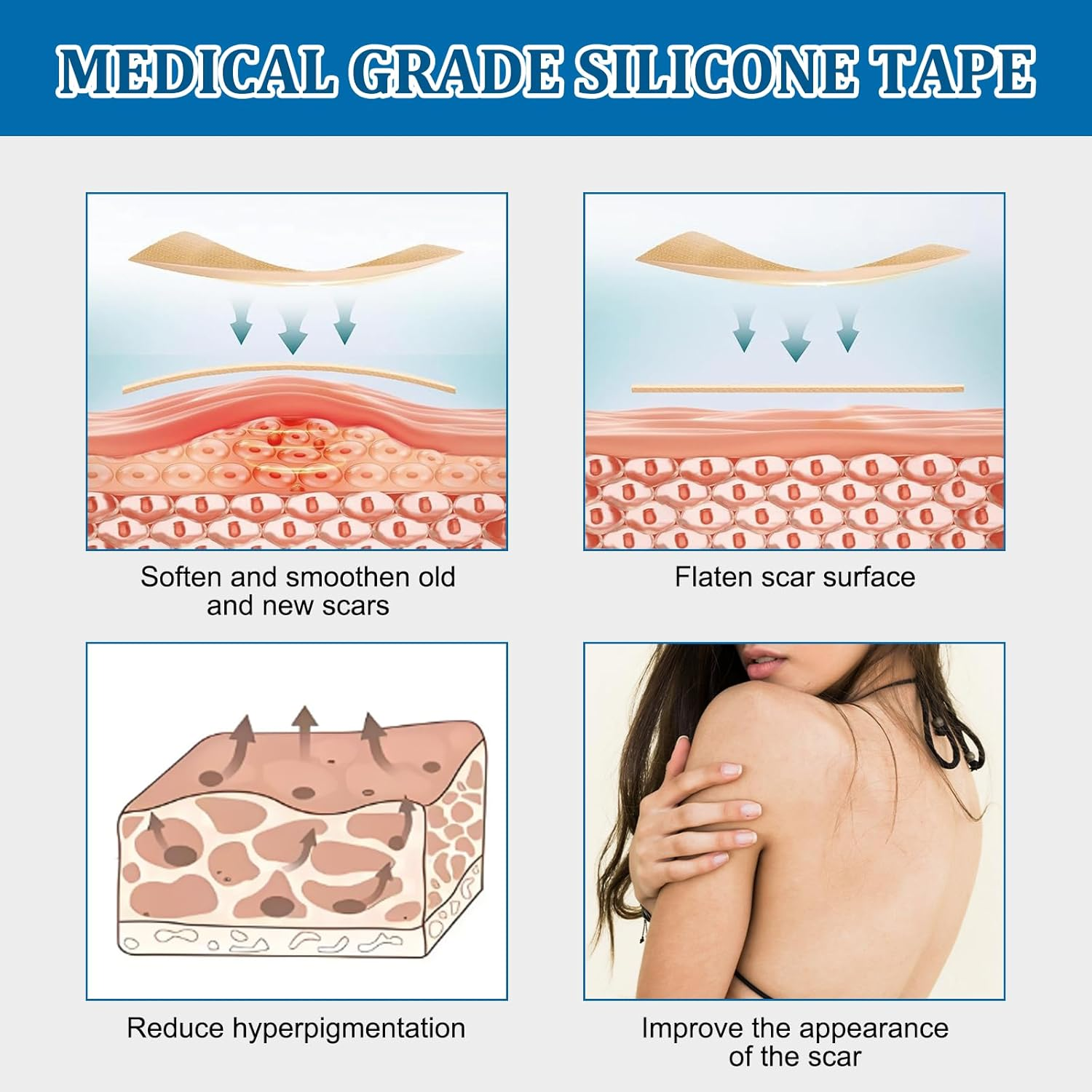 Silicone Scar Tape(3M - 1.6'' X 120''Roll) - Scar Removal Soft Silicone Scar Sheets Strips- Medical Grade, Reusable Gel Scar Tape for Keloid Surgery, C-Section, Acne and Burn image number 4