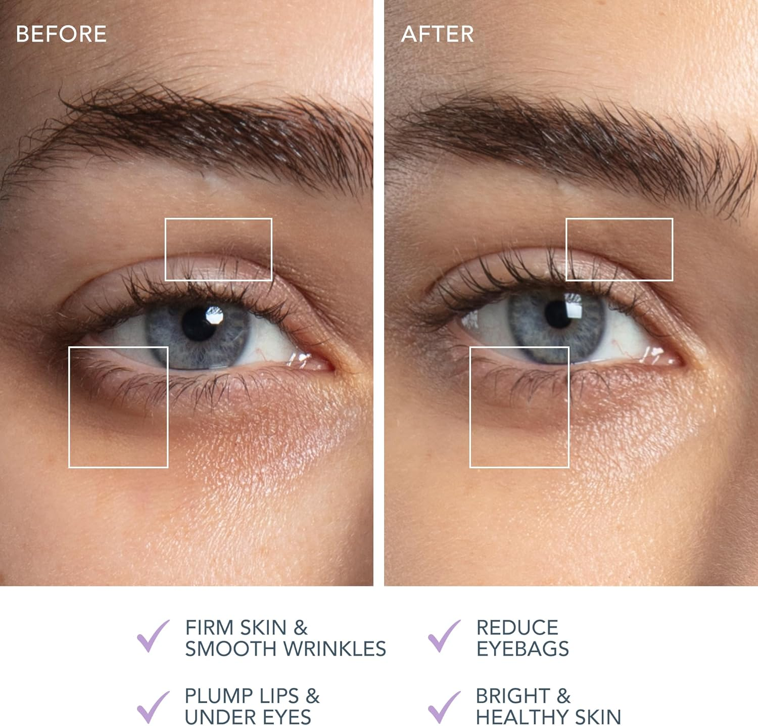 FOREO Bear 2 Eyes & Lips - Microcurrent Line Smoothing Instant Face Lift - - Eye Care Device - Brow Lift - Dark Circles under Eye Treatment & Lip Plumper Device - Firming Beauty Products - Lavender