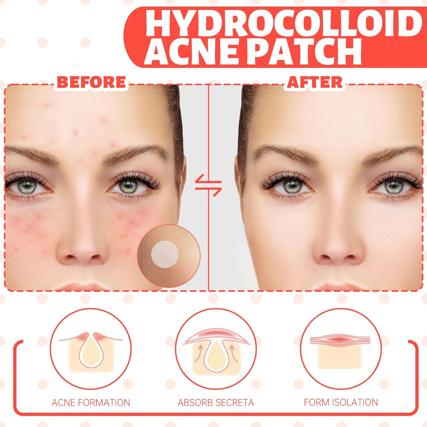 360Pcs Pimple Patches for Face, Acne Patches 2 Size, Hydrocolloid Patches for Covering Zits and Blemishes, Invisibly Thin Spot Stickers for Face and Skin, 288Pcs Day Use + 72Pcs Night Use (360) image number 1