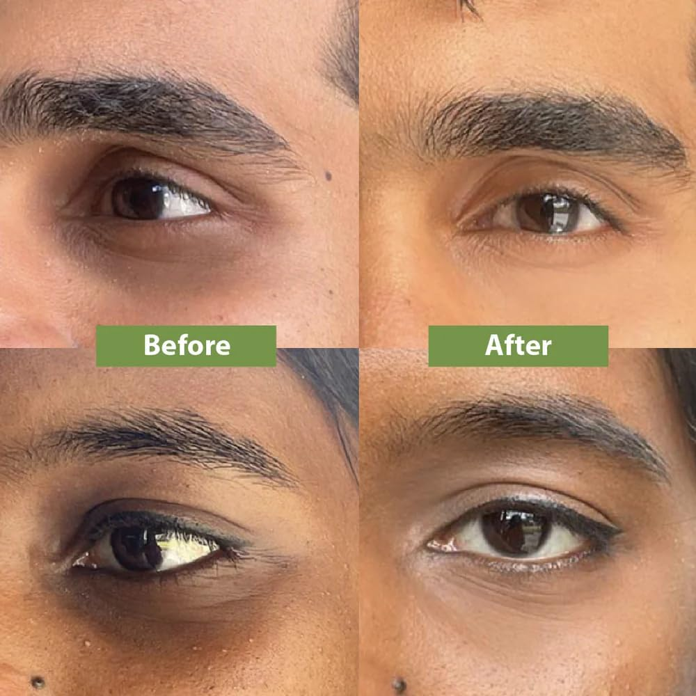 Vilvah Store under Eye Cream | for Dark Circles, Eye Puffiness, Fine Lines & Wrinkles | Minimizes Darkened, Stressed Appearance, Wrinkles, Puffiness around the Eye | with Natural Ingredients, 20Ml image number 2