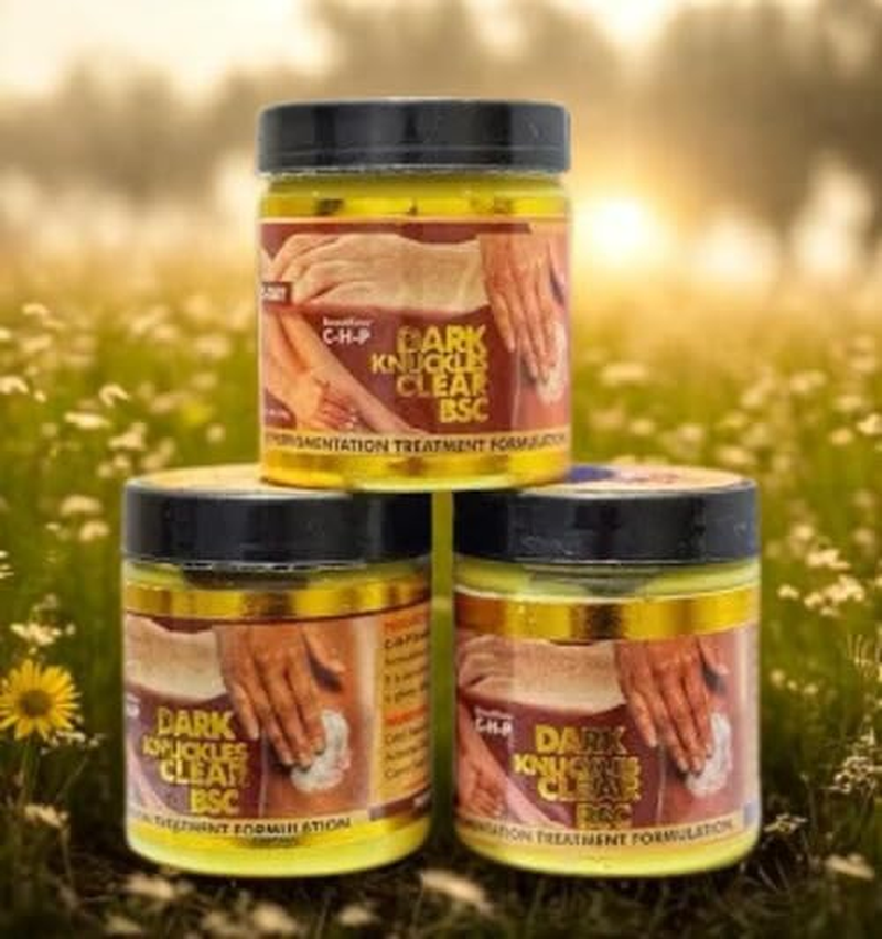 Dark Knuckles Clear &ndash; Hyperpigmentation Treatment Cream | Brightening Knuckle & Elbow Corrector | Fade Dark Marks & Discoloration | Smooth & Even Tone