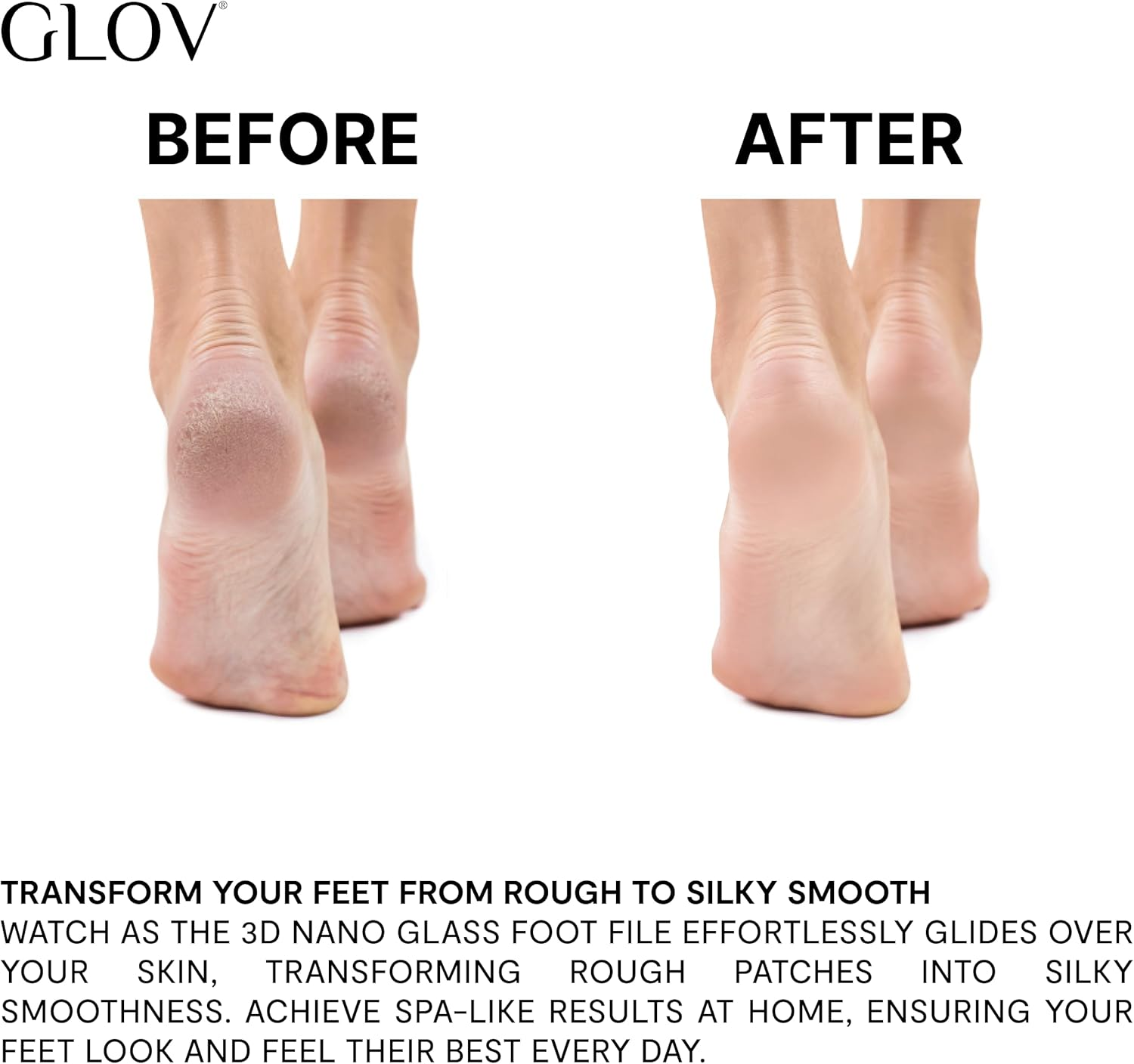 Glov 3D Nano Foot File Glass Material Black Ergonomic Reusable Gentle Callus Removal for Dry and Wet Skin Durable Care Product for Foot Health and Foot Care image number 4