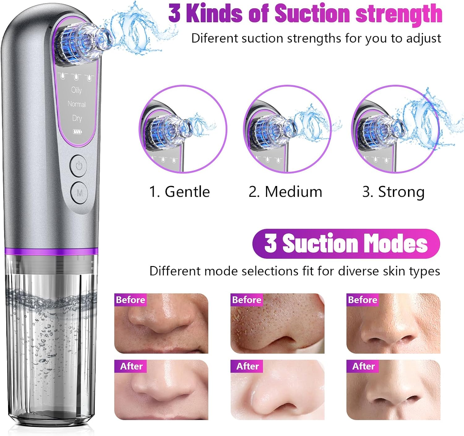 Blackhead Remover, Pore Cleaner, Euakee Vacuum Suction, Blackhead Suction, Pore Cleaner, 5 Suction Heads, 3 Modes, USB Charging Facial Cleaning, Picke Vacuum, Acne Remover, Device Blackhead Remover image number 6