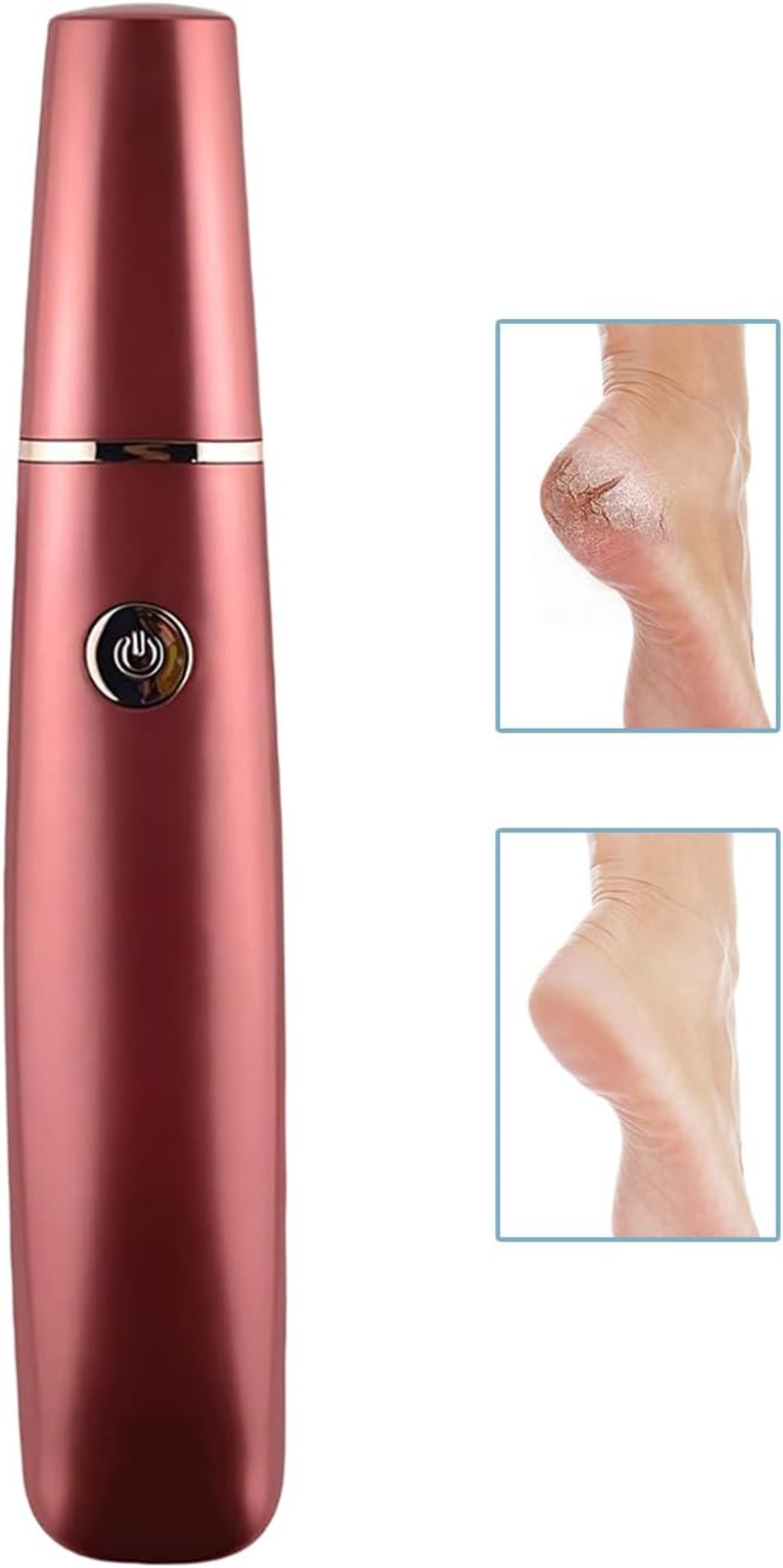 Callus Remover for Feet,Electric Foot File Callus Remover | Electronic File Scrubber Pedicure Kit for Cracked Hard Dead Skin Peeling Heel Care image number 4