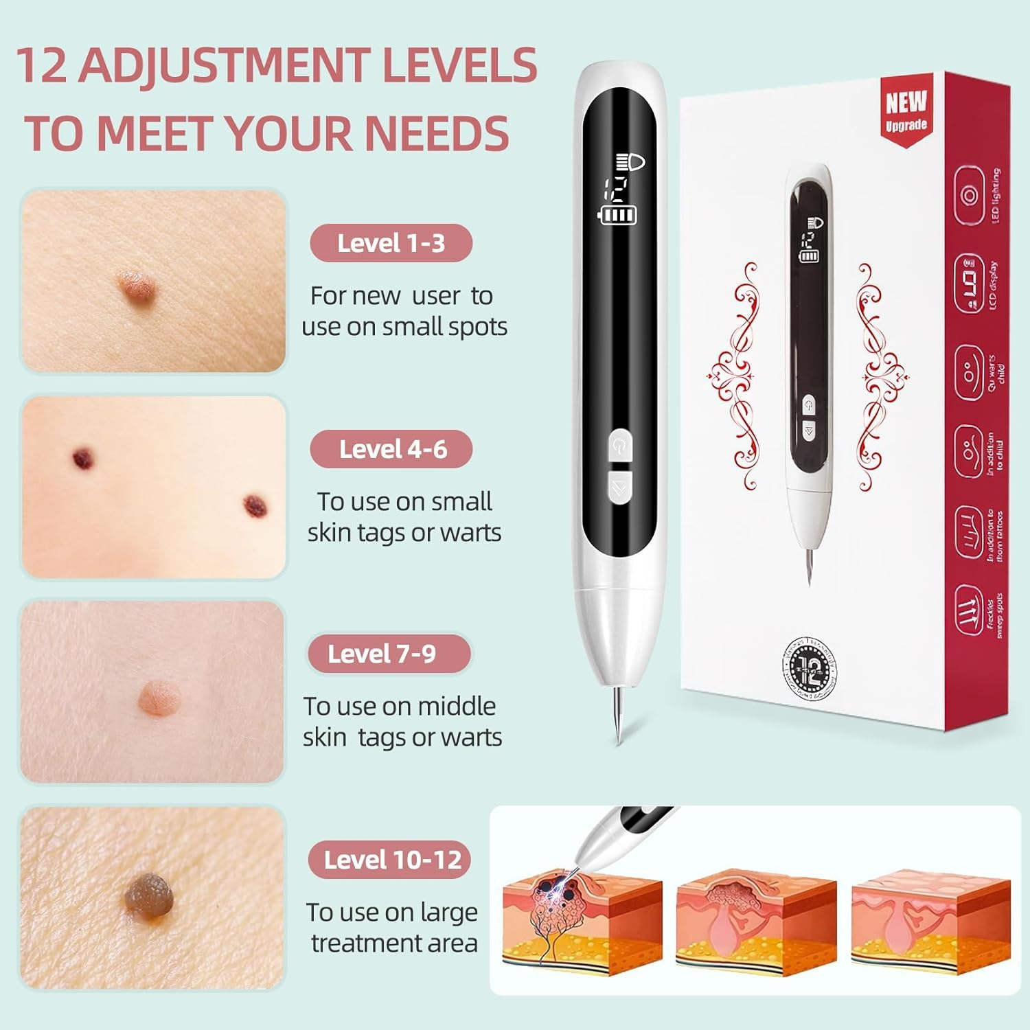 AL-40 Skin Removal Kit, Design to Smooth Your Skin, Safe and Effective for Home Use, Easy to Use Skin Tag Remover Kit