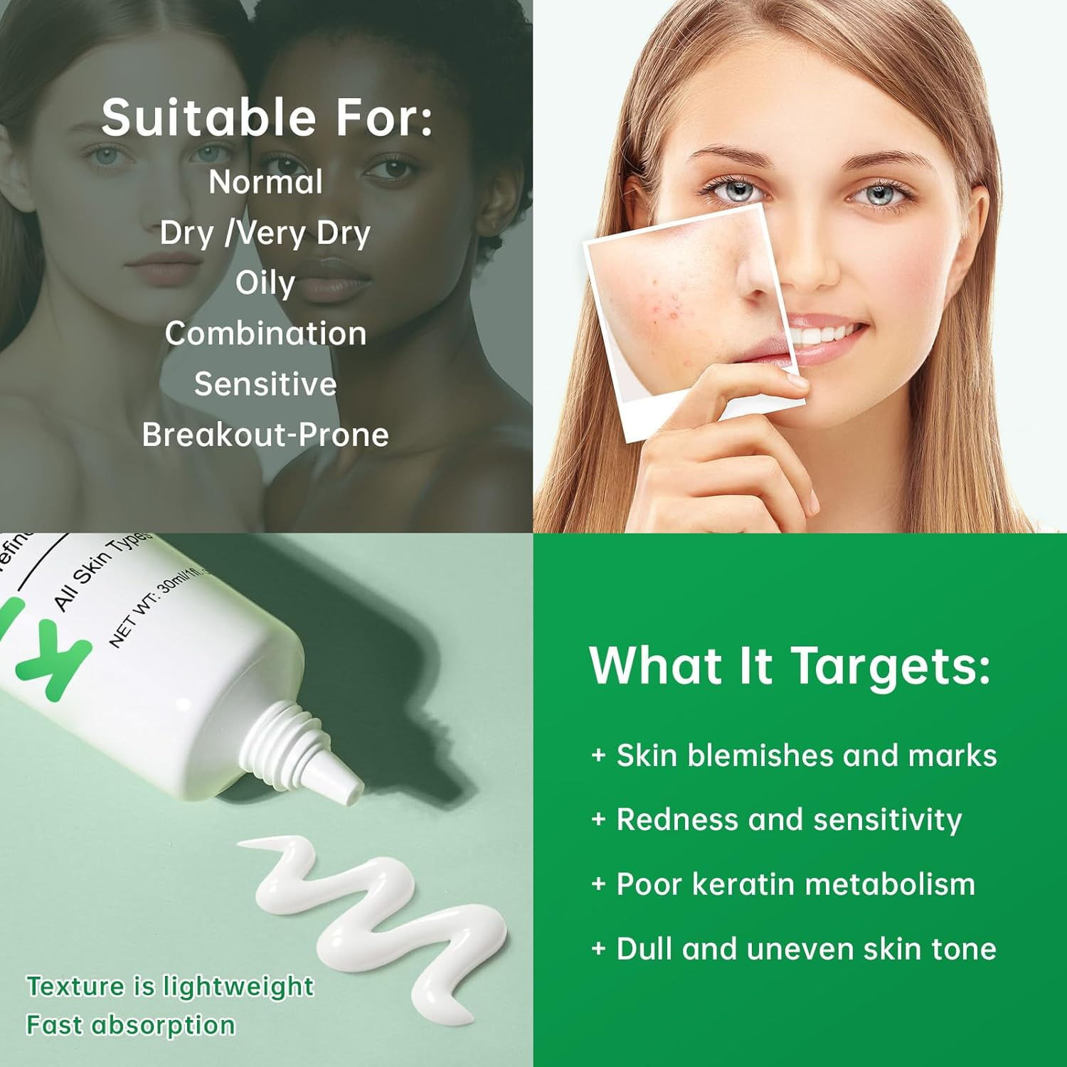 Azelaic Acid Boost Cream, 10% Azelaic Acid Booster Cream Gel for for Acne and Blemishes with Salicylic Acid, Balances Excess Sebum, Purifies Skin & Improves Skin Tone for All Skin Types, 30Ml image number 3