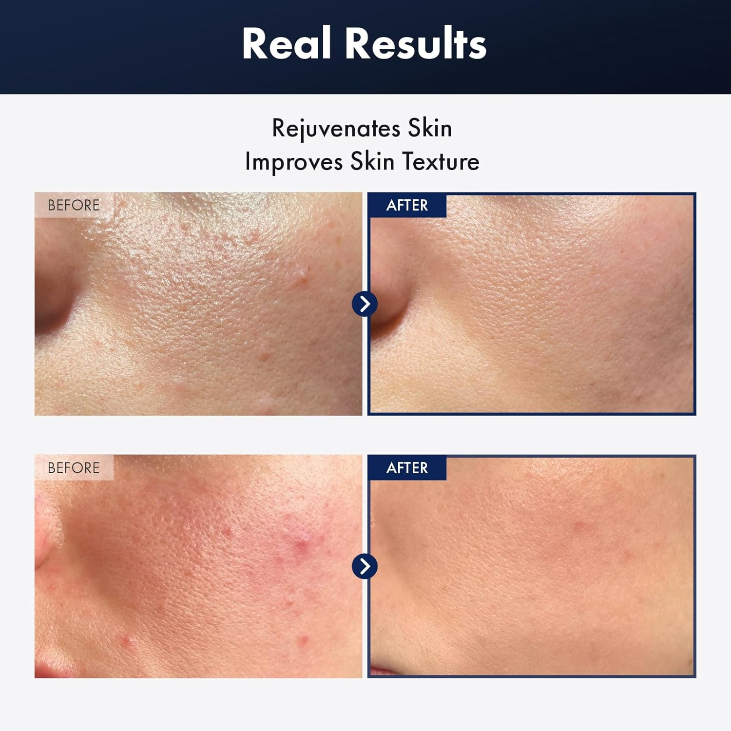 TOSOWOONG Black Snail plus Essence with 960,890Ppm Black Snail Secretion Filtrate, Hydrating Serum, Repairing, anti Aging, Dull Skin, Fine Lines, Sensitive Skin, Korean Skin Care, 100Ml, 3.38 Fl.Oz. image number 4