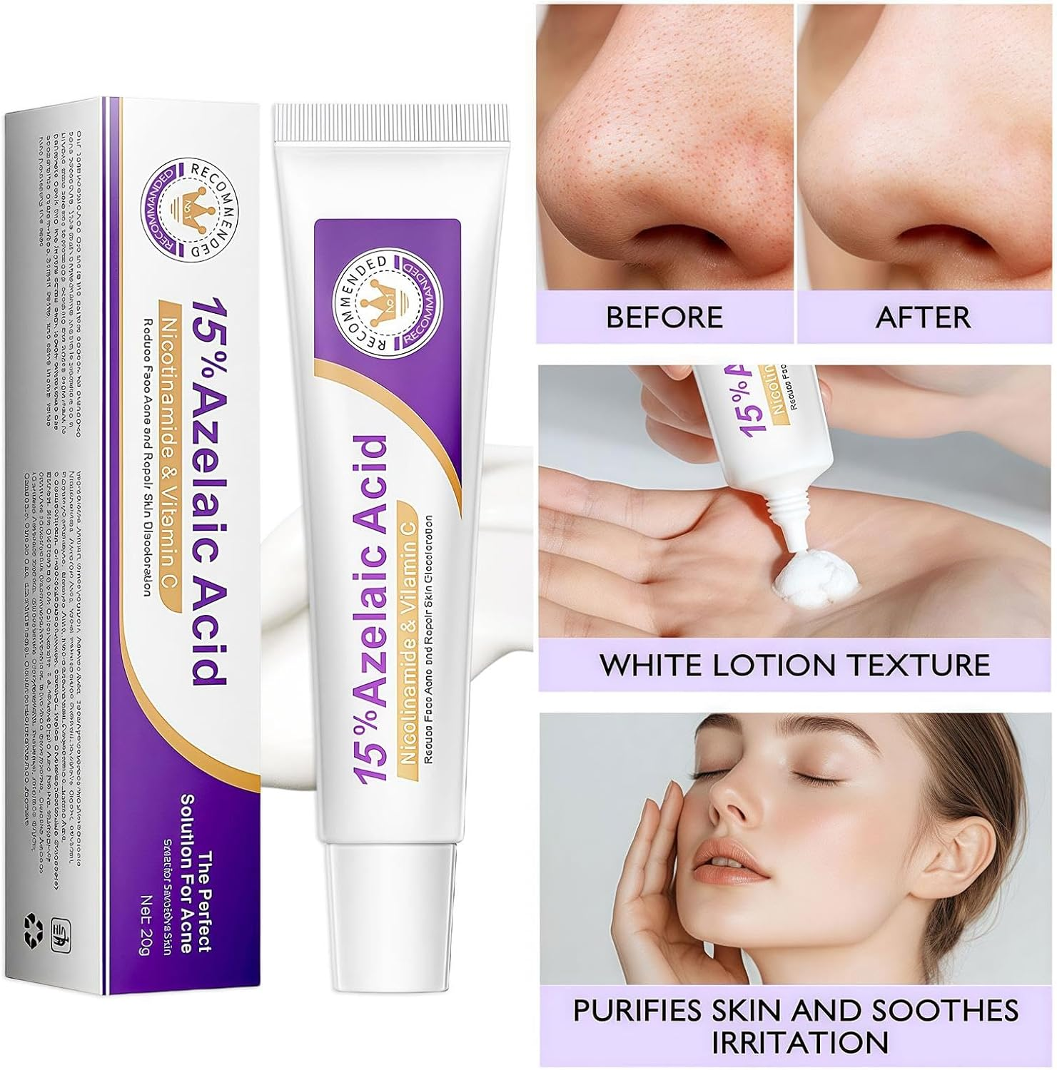 Ai-Uchoice Azelaic Acid 10% Cream for Face Body, 0.7 OZ Azelaic Acid Acne Cream Gel with Salicylic Acid for Skin Balancing Nourishing for Sensitive Skin Care & Daily Routines (Ai-Uchoice, 15% Azelaic Acid Cream) image number 6