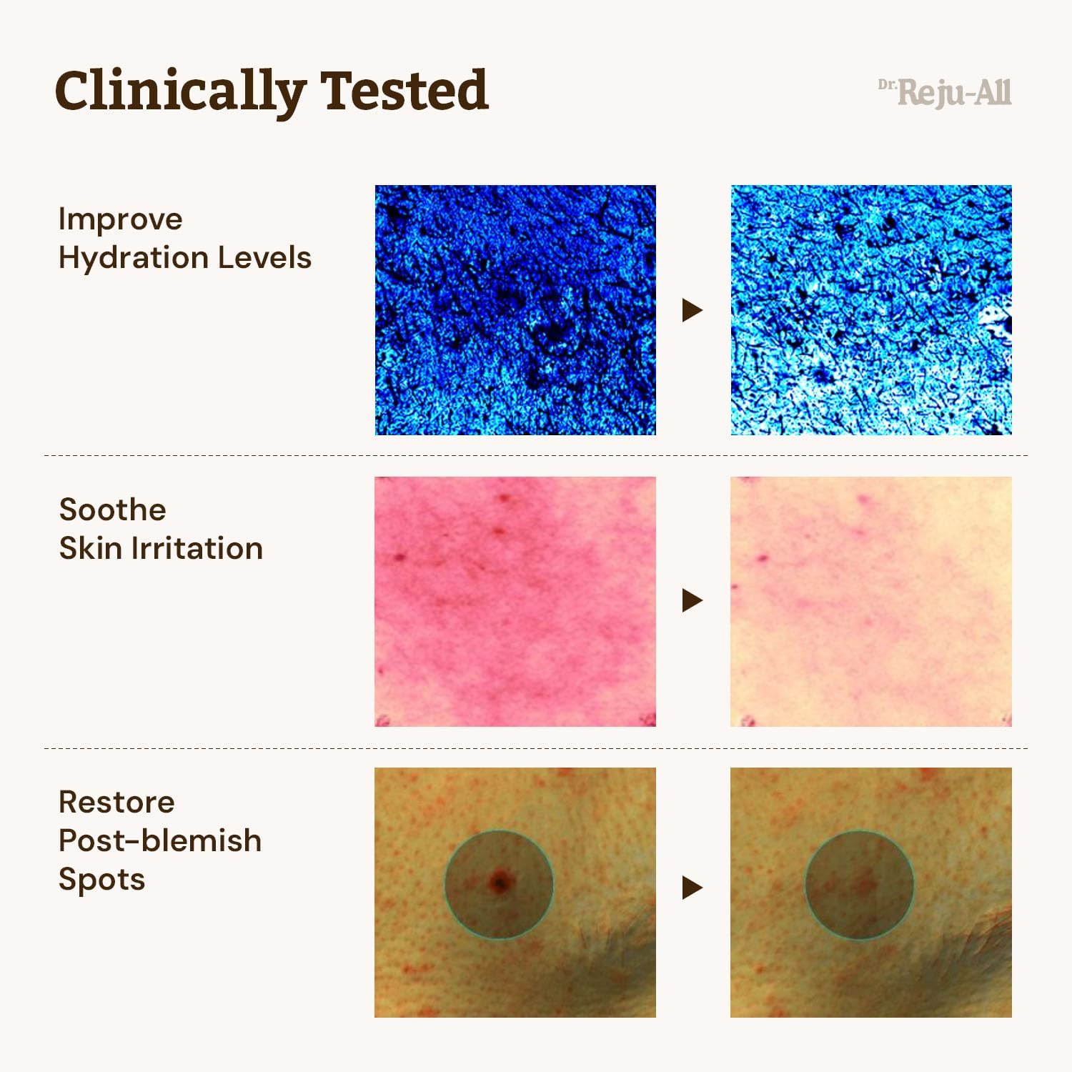 Dr. Reju-All Advanced PDRN Rejuvenating Cream - 99% Pure Salmon DNA PDRN Face Moisturizer - Korean Skin Care Face Cream - 20Ml