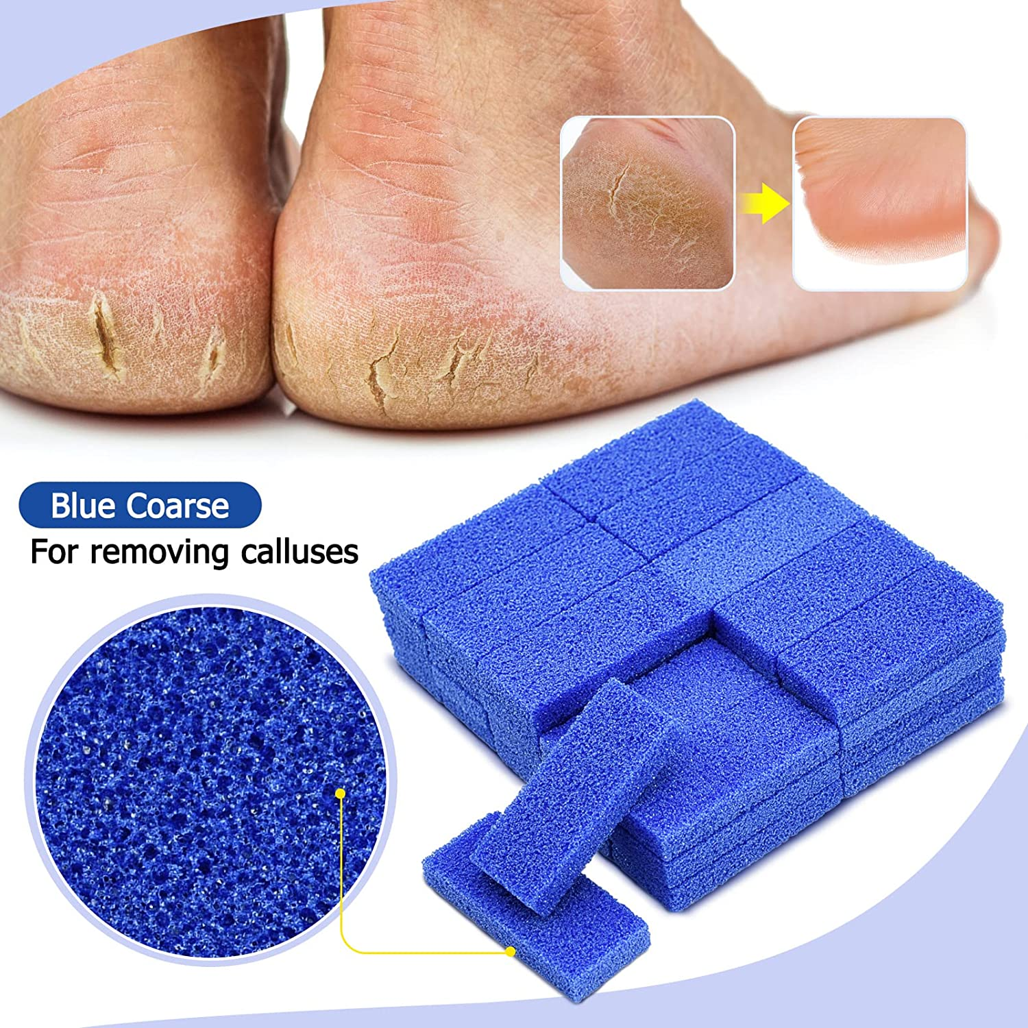Disposable Foot Scrubber Sponge Pads Pedicure Pumice Stone for Feet Callus Remover Coarse Blue 40Pcs image number 6