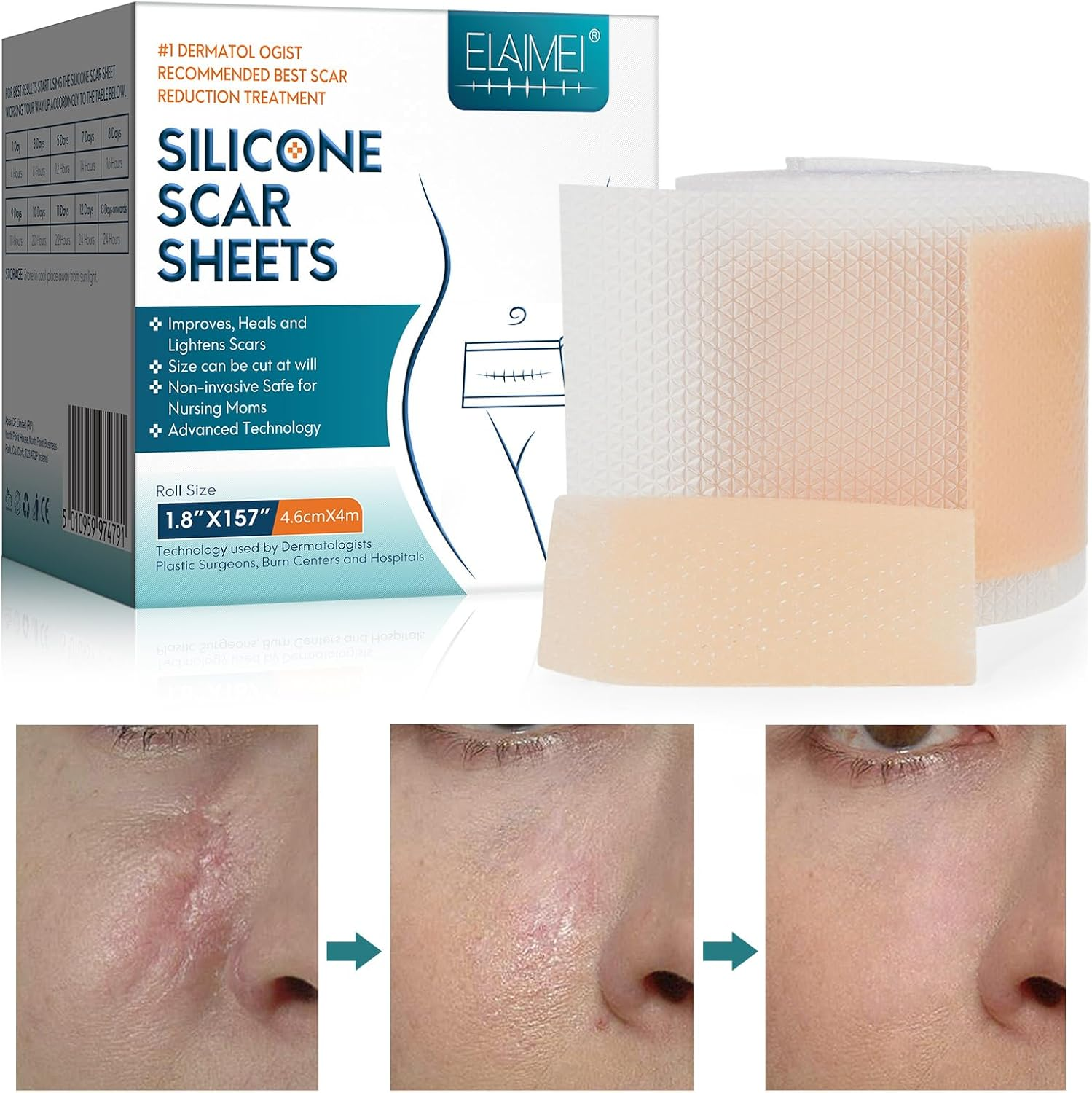 Silicone Scar Tape(1.8" X 157" Roll - 4M), Silicone Scar Sheets, Silicone Scar Tape Roll, Scar Silicone Strips, for C-Section, Surgery, Burn, Keloid, Acne Etc image number 3