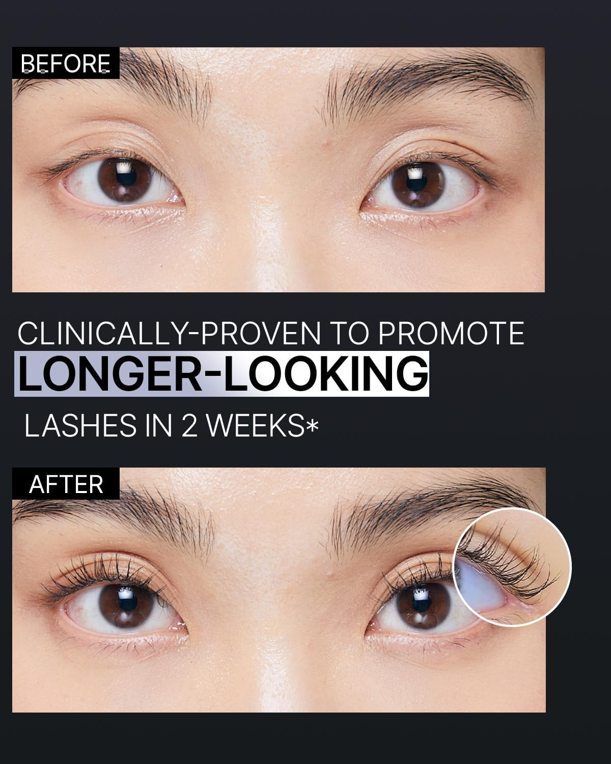 EPAIS Essential Eyelash Growth Serum, Jumbo Size 15Ml/0.5Fl.Oz - Safe & Gentle Lashes Care, Nutrient Formula for Longer, Fuller, Thicker in 2 Weeks, to Grow Lashes Natural Longer, Non-Prostaglandin image number 2