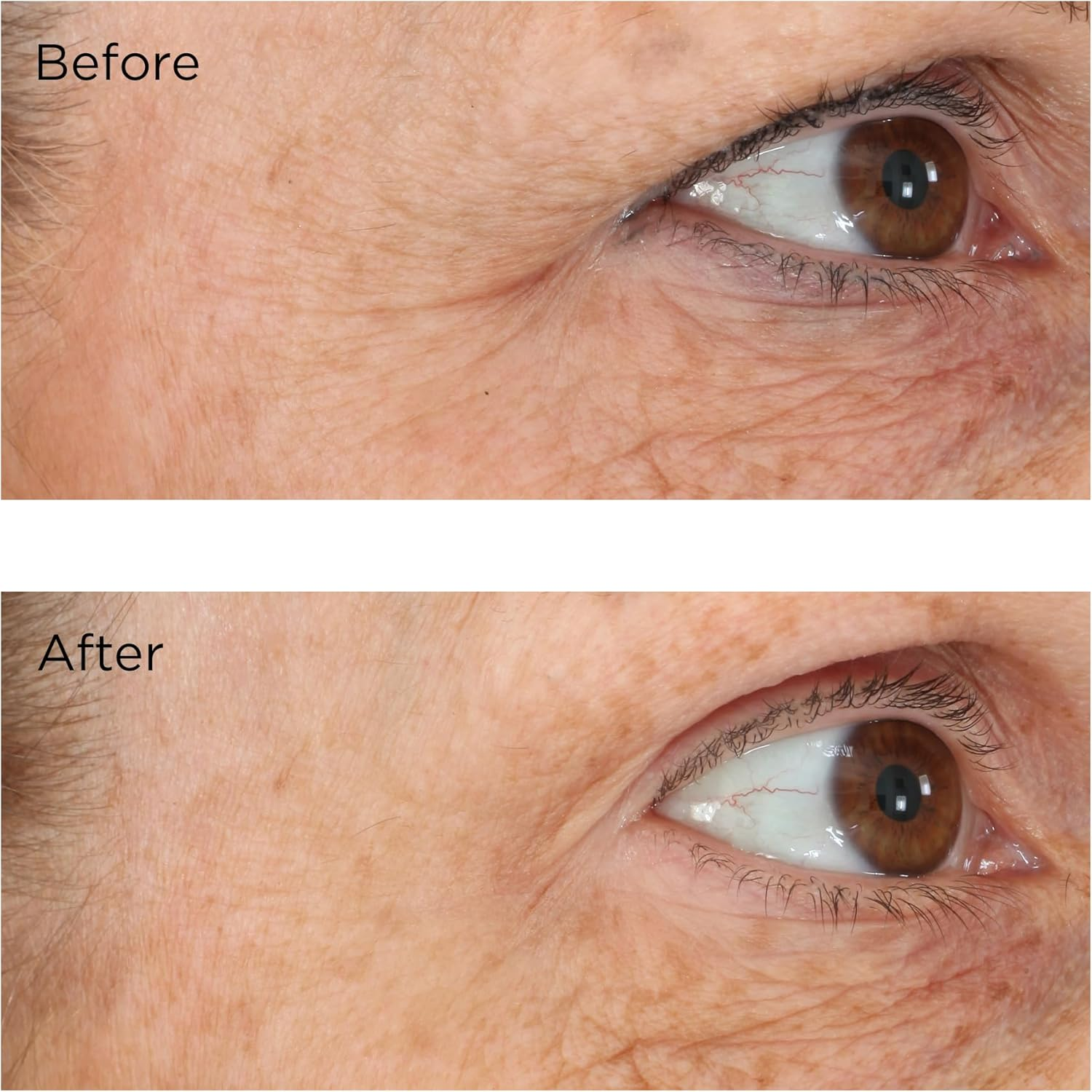 Perricone MD Essential FX Acyl-Glutathione Eyelid Lift Serum, 15Ml image number 2