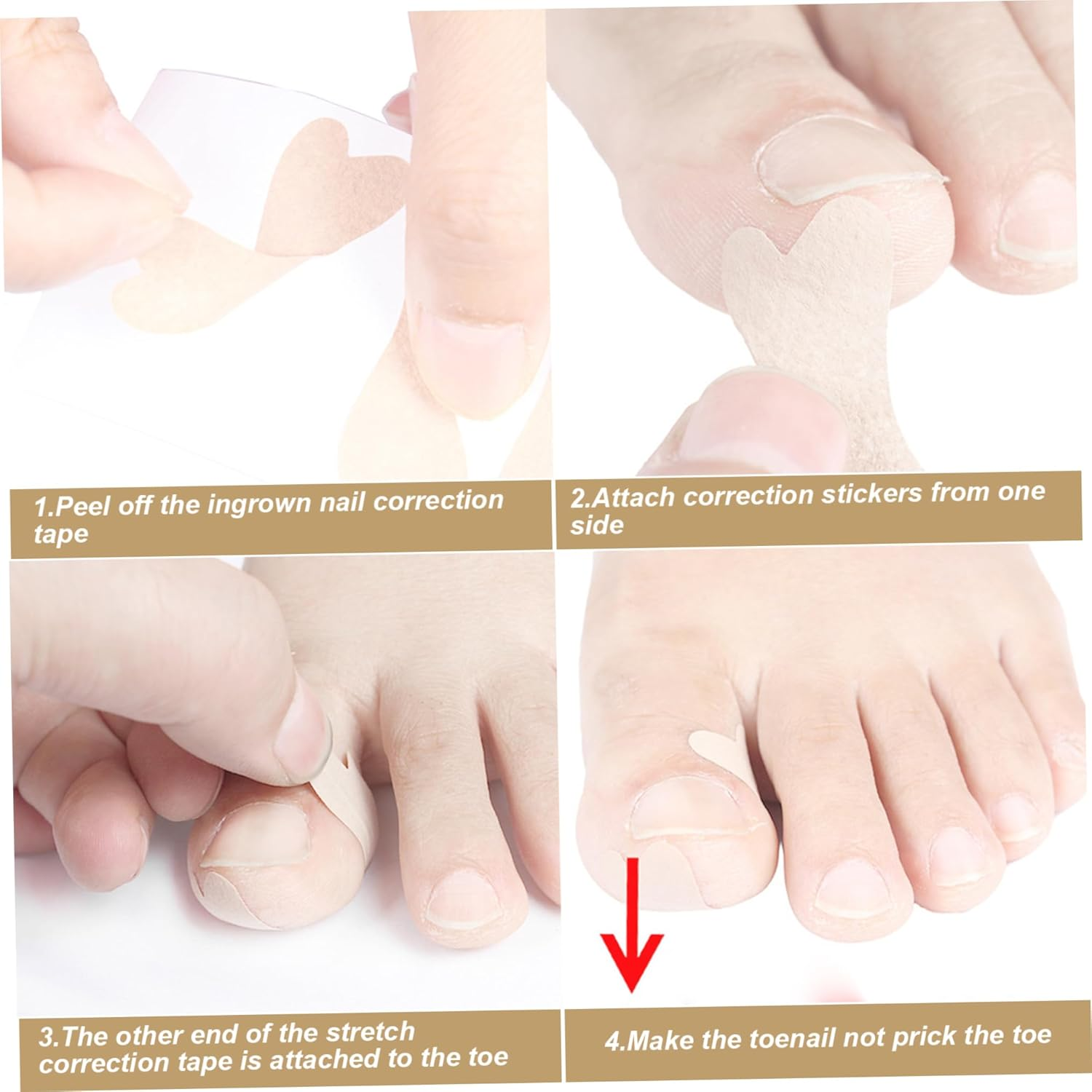 Ingrown Toenail Corrector, 180PCS Breathable Self-Adhesive Ingrown Toenail Patches, Pain Relief Nail Patches image number 3