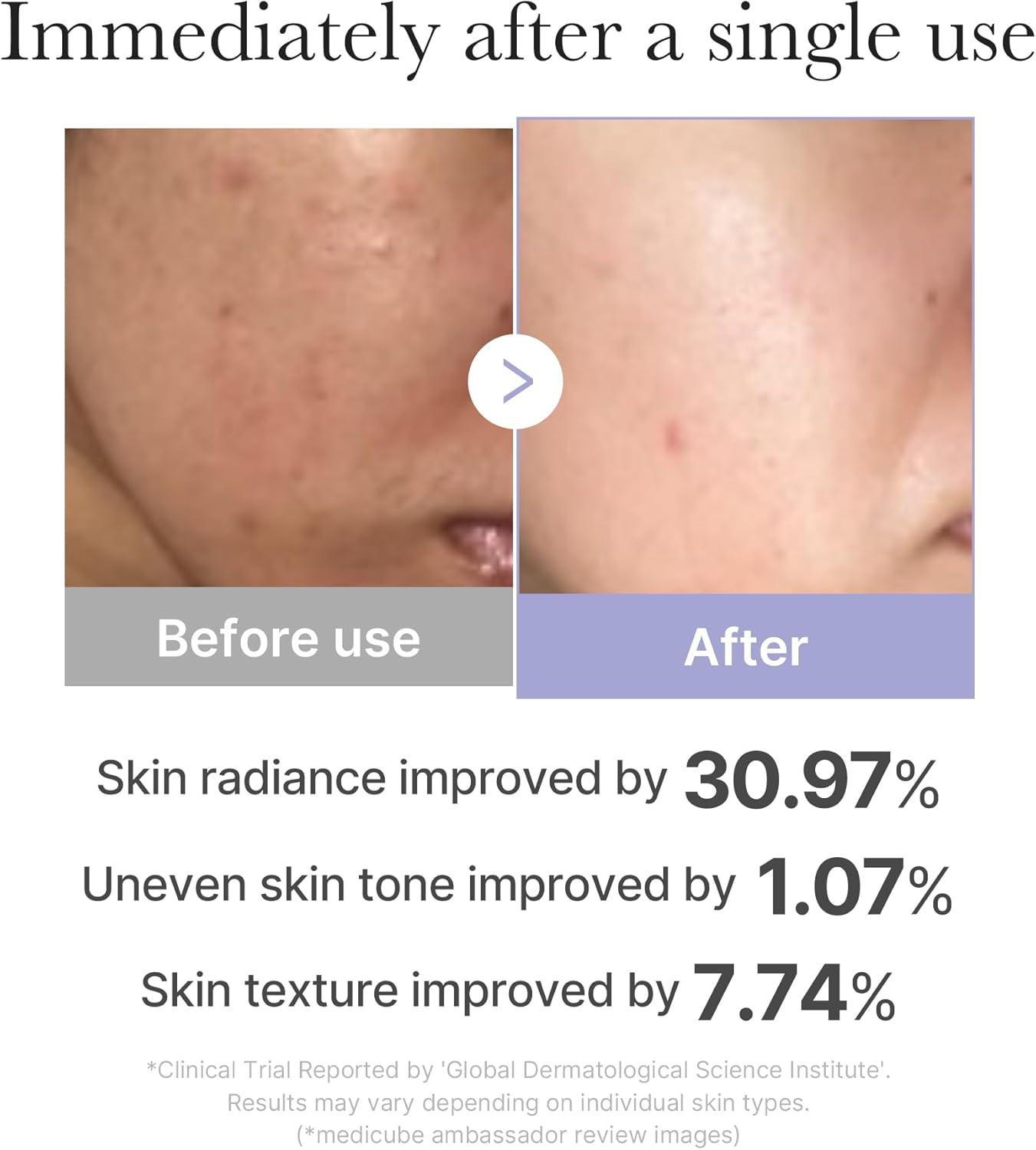 Medicube Mini Booster Pro Pink | Affordable At-Home Facial Skin Care Tool for Beginners - Portable Glow Booster for Glass Skin, Boosting Skin Care Absorption, Skin Care for Teens, Korean Skin Care image number 2